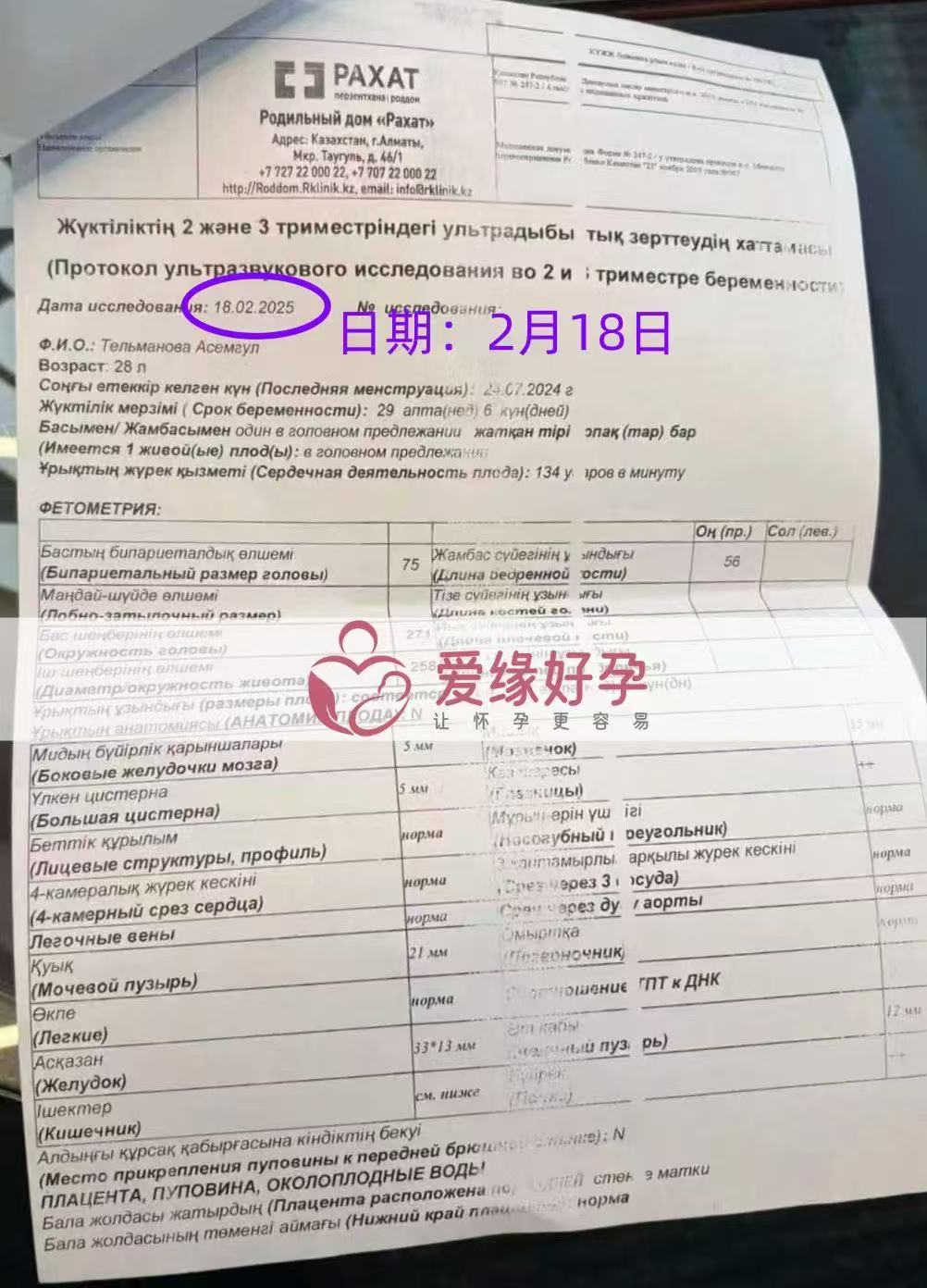 格鲁吉亚代孕代孕代母29周产检过关，孕期进展顺利