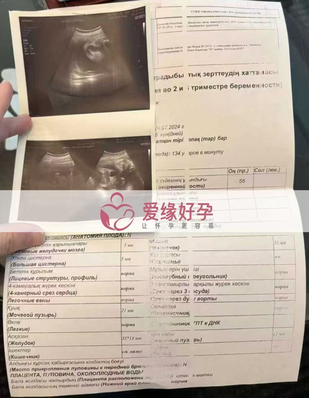 格鲁吉亚代孕代孕代母29周产检过关，孕期进展顺利