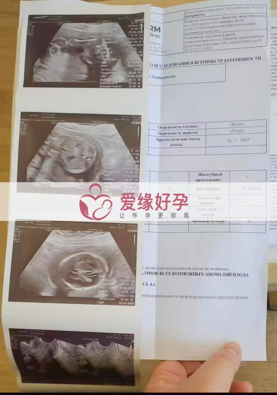哈萨克斯坦代孕代孕代母21周产检顺利通过