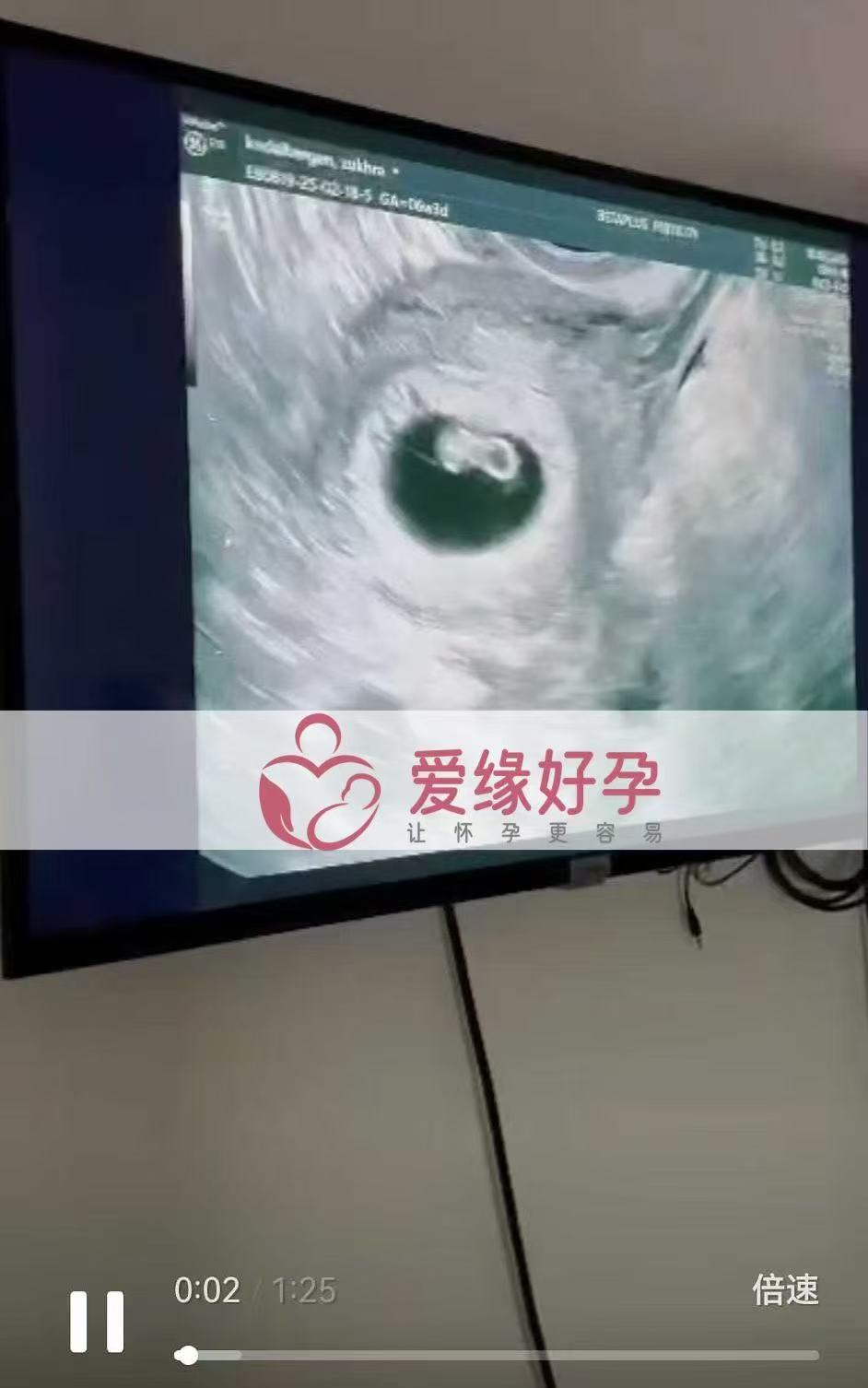 格鲁吉亚代孕代孕代母6周产检通过，孕期迈出第一步
