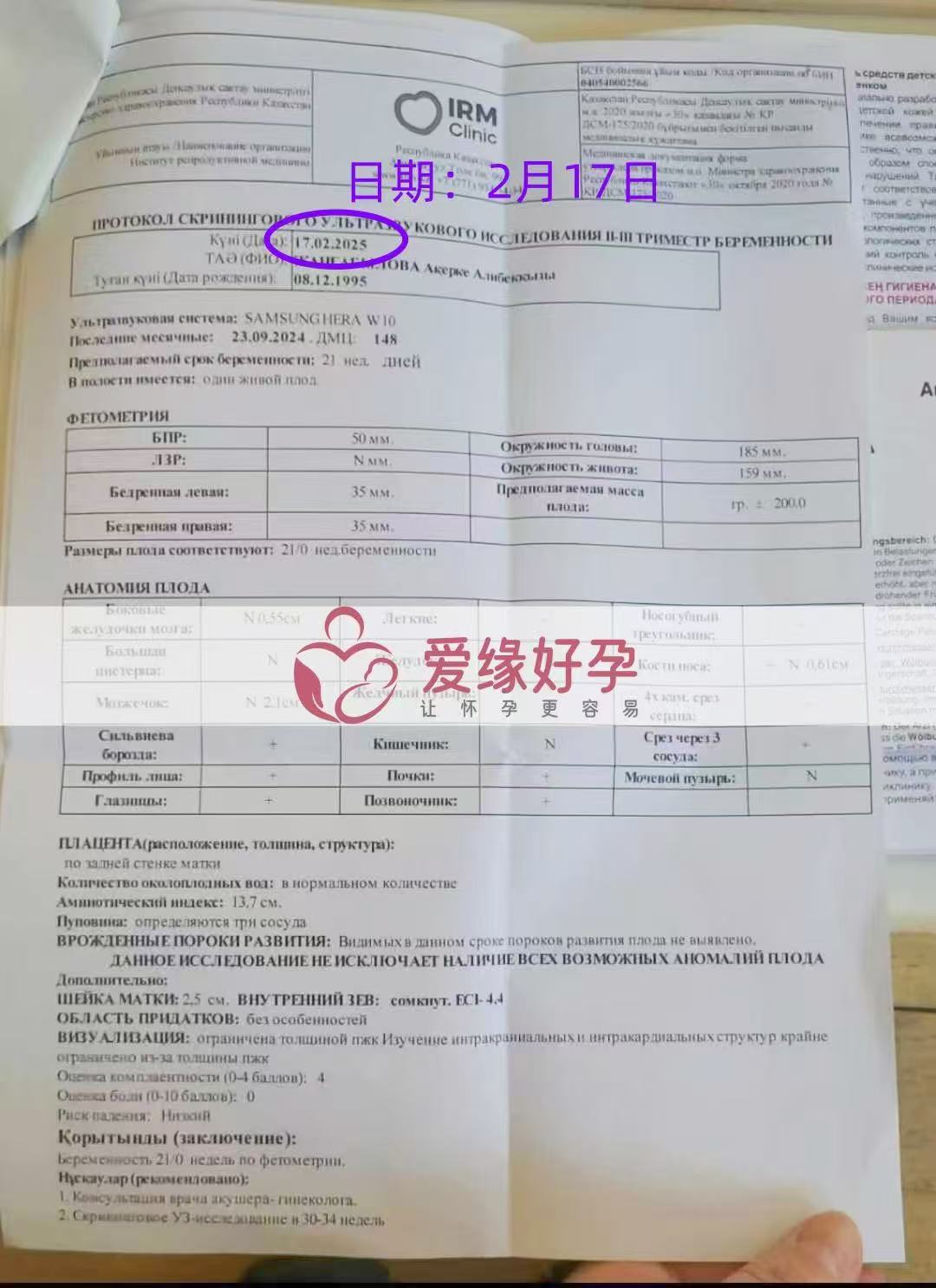 哈萨克斯坦代孕代孕代母21周产检顺利通过