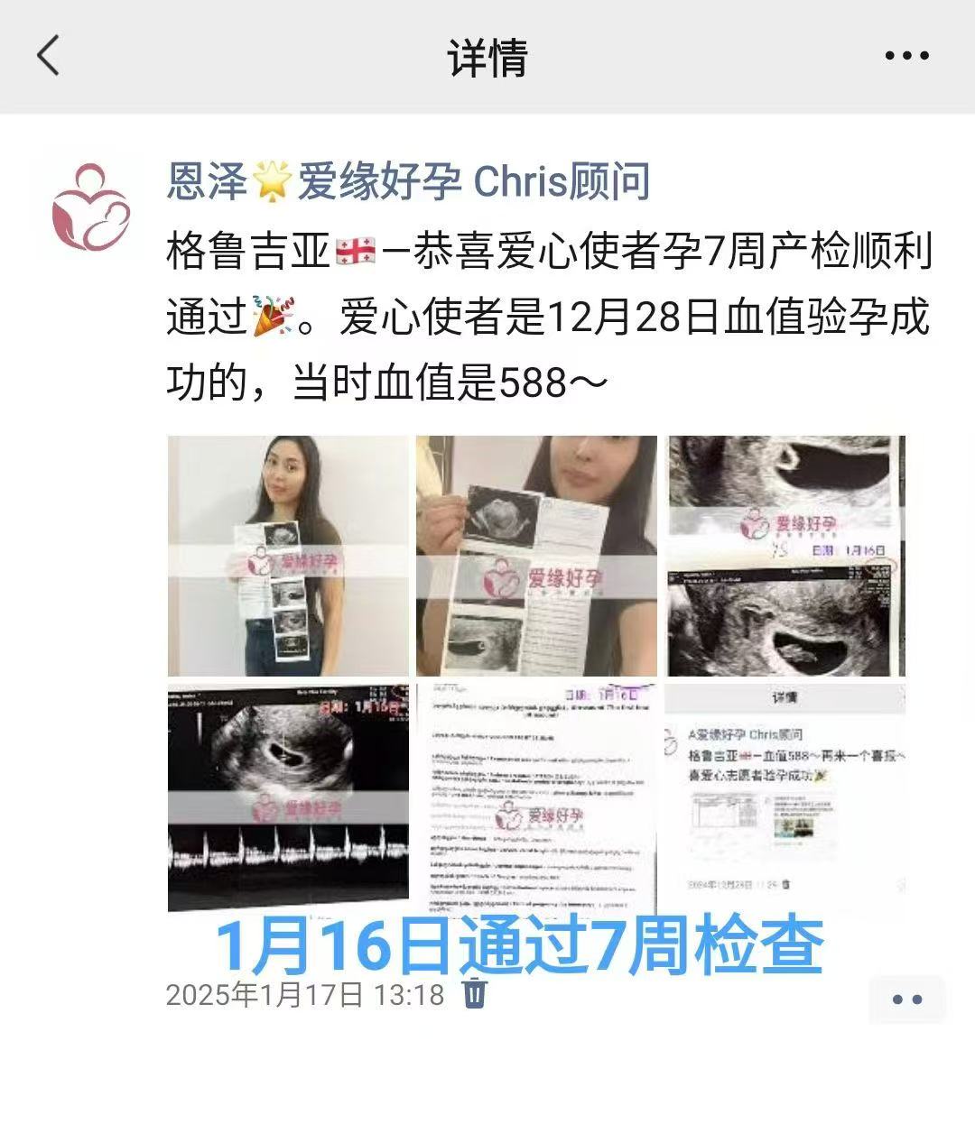 格鲁吉亚代孕代孕代母顺利通过12周检查，正式进入稳定期
