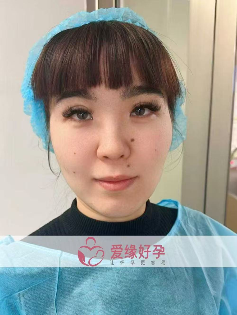 格鲁吉亚代孕代孕代母顺利完成移植
