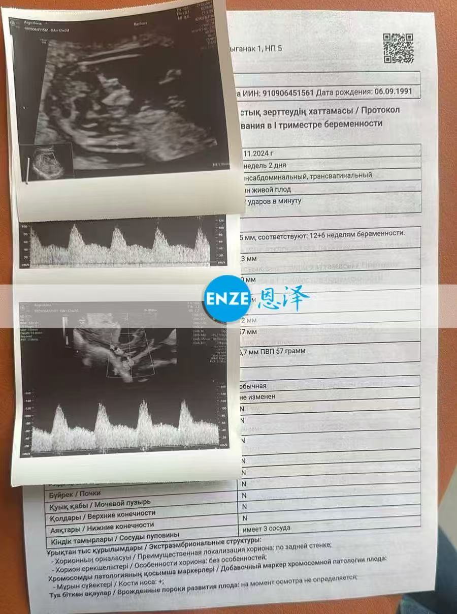 格鲁吉亚代孕代孕代母顺利通过12周检查，正式进入稳定期