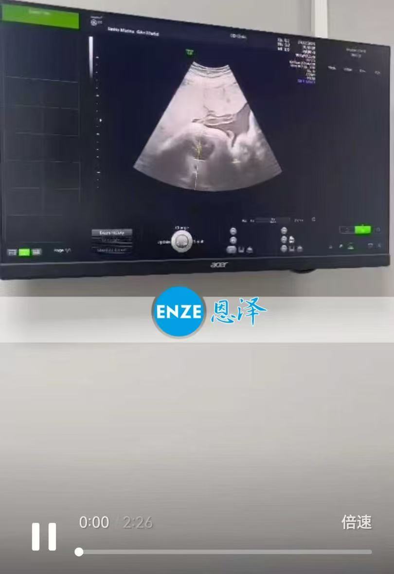 格鲁吉亚代孕代孕代母37周产检顺利，静待宝宝到来