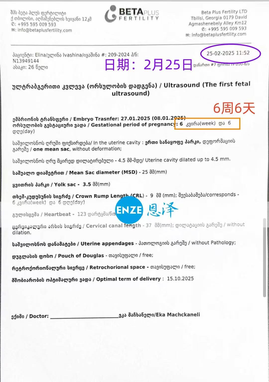 格鲁吉亚代孕代孕代母6周第一次产检顺利通过