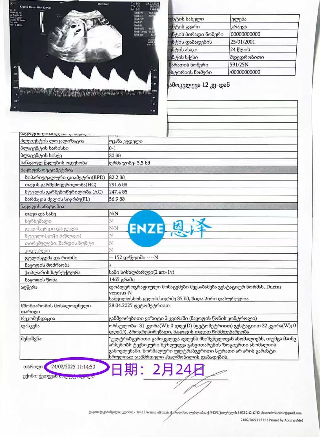 格鲁吉亚代孕代孕代母32周产检顺利通过