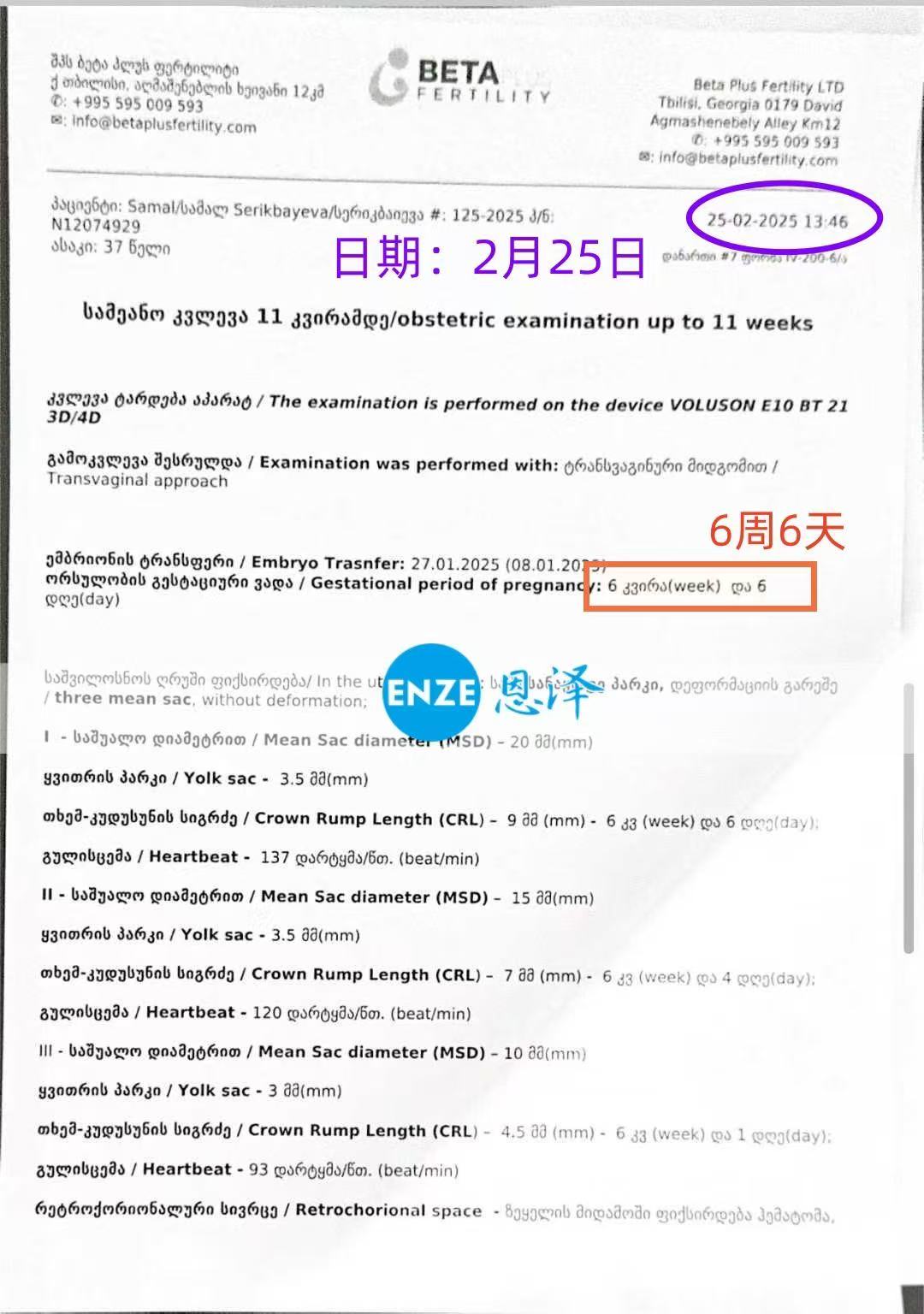 格鲁吉亚代孕代孕代母同卵三胞胎6周检查顺利通过