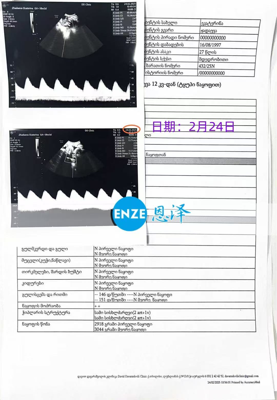 格鲁吉亚代孕代孕代母38周产检顺利，孕期进入尾声