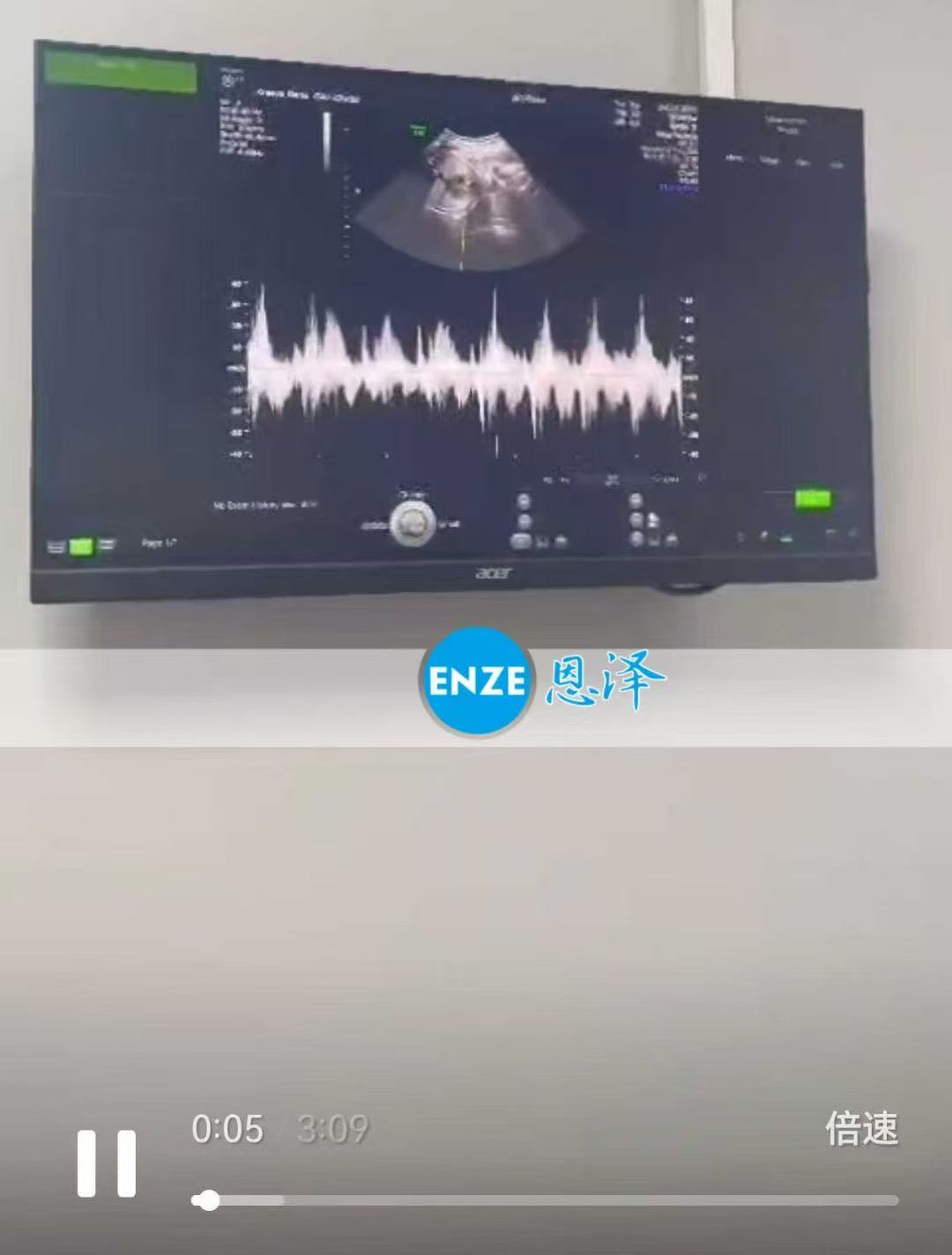 格鲁吉亚代孕代孕代母32周产检顺利通过