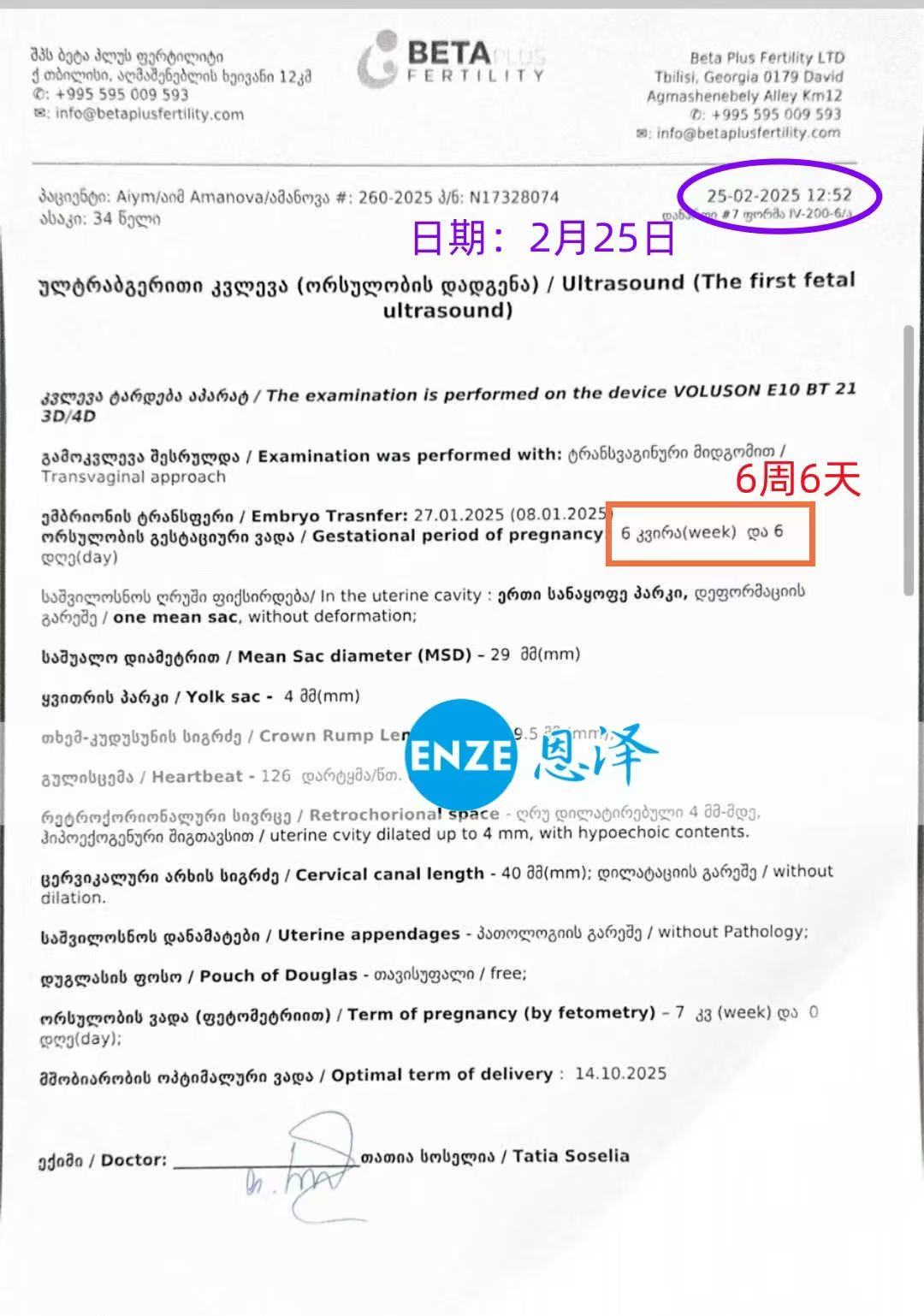 格鲁吉亚代孕代孕代母6周产检顺利通过
