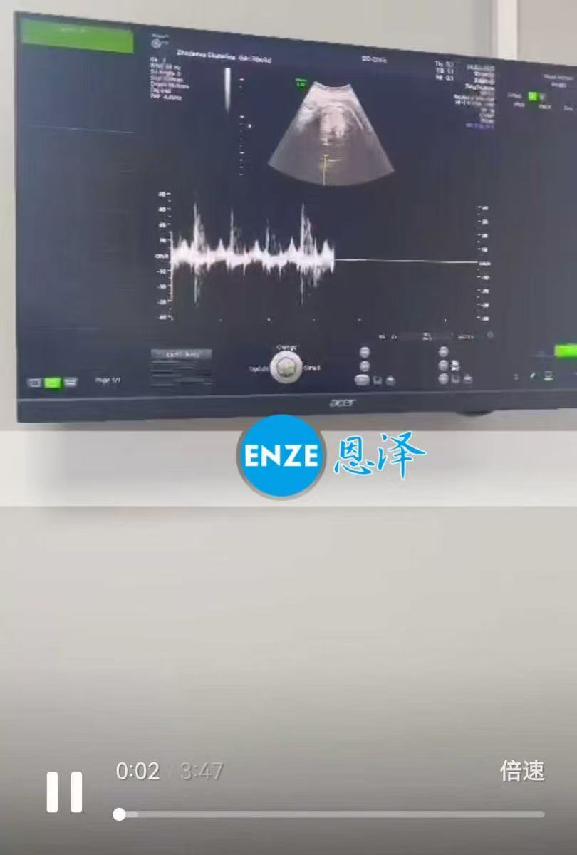 格鲁吉亚代孕代孕代母38周产检顺利，孕期进入尾声