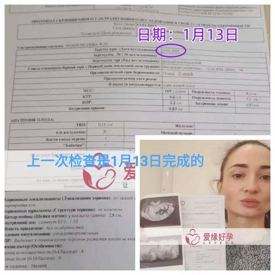 格鲁吉亚代孕代孕代母19周产检顺利通过