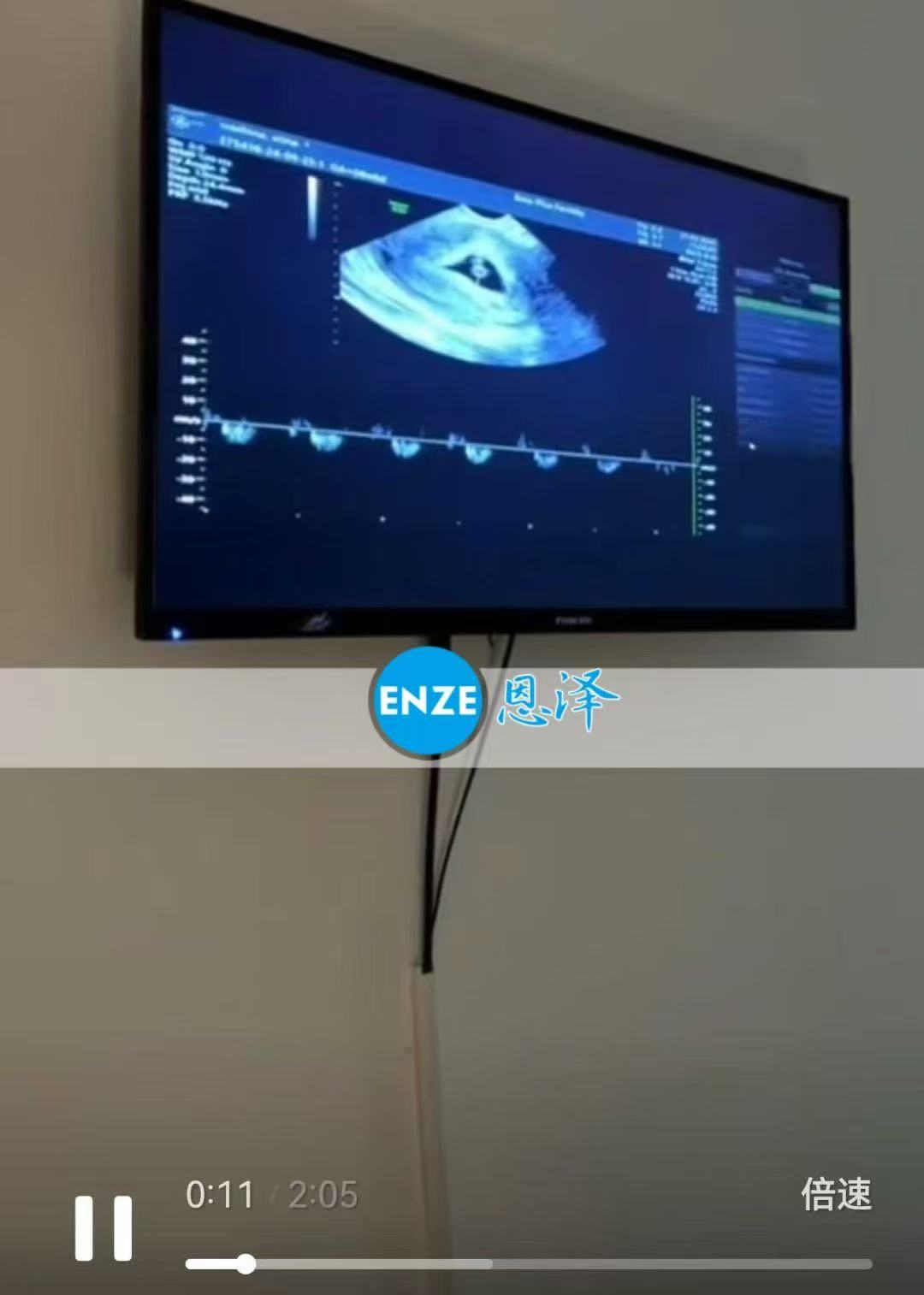 格鲁吉亚代孕代孕代母6周第一次产检顺利通过