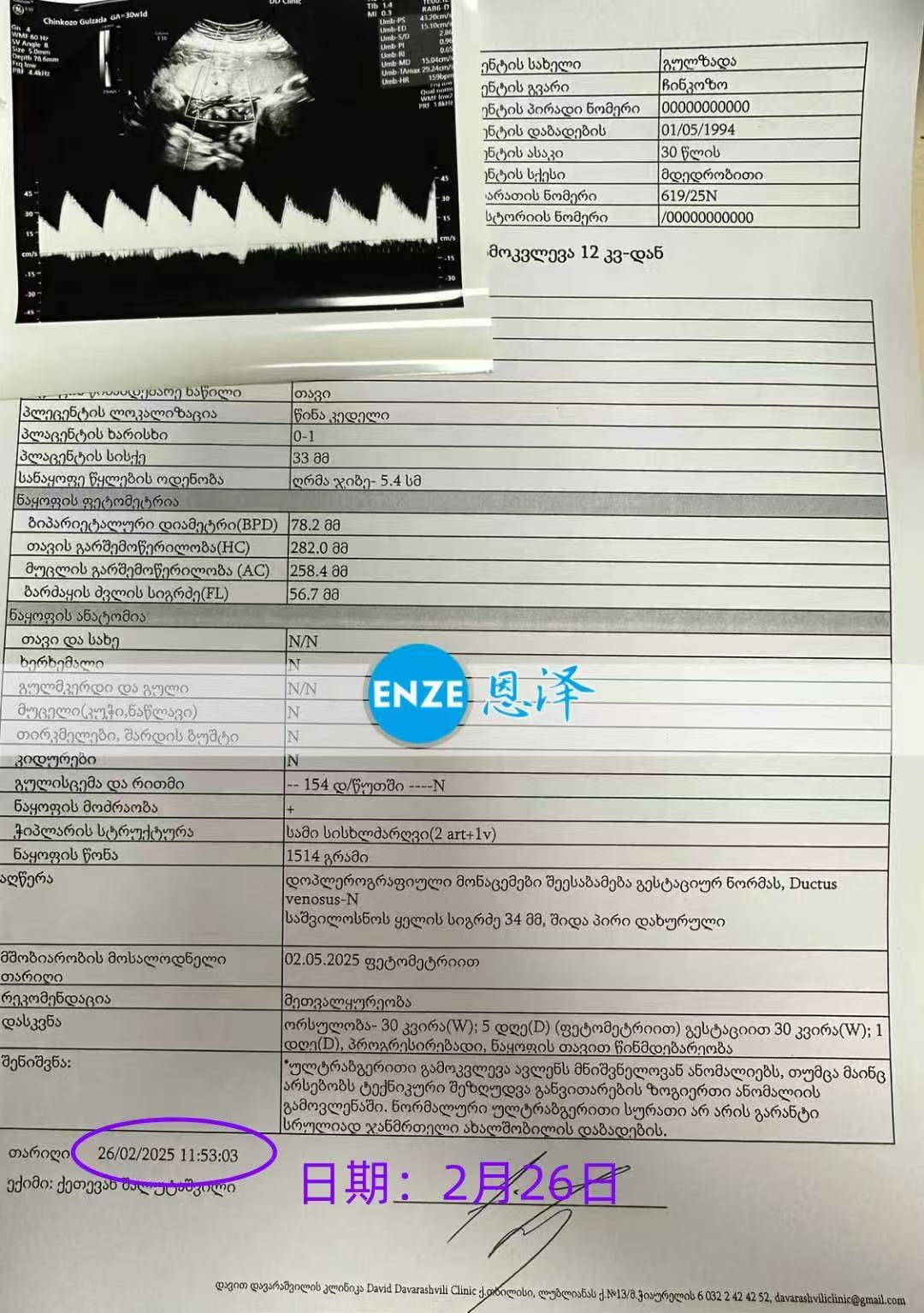格鲁吉亚代孕代孕代母30周产检顺利通过