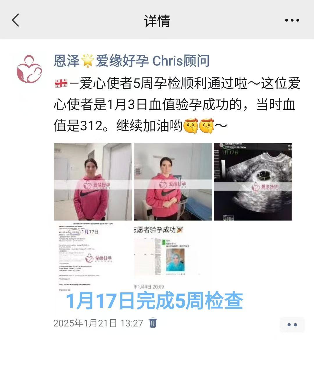 格鲁吉亚代孕代孕代母12周产检顺利，步入稳定期