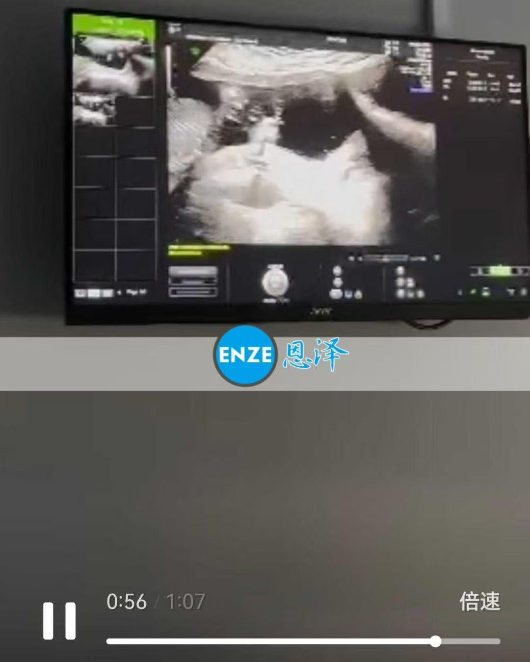 格鲁吉亚代孕代孕代母17周产检顺利过关
