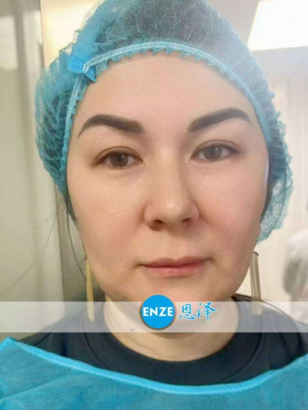 格鲁吉亚代孕代母着床成功