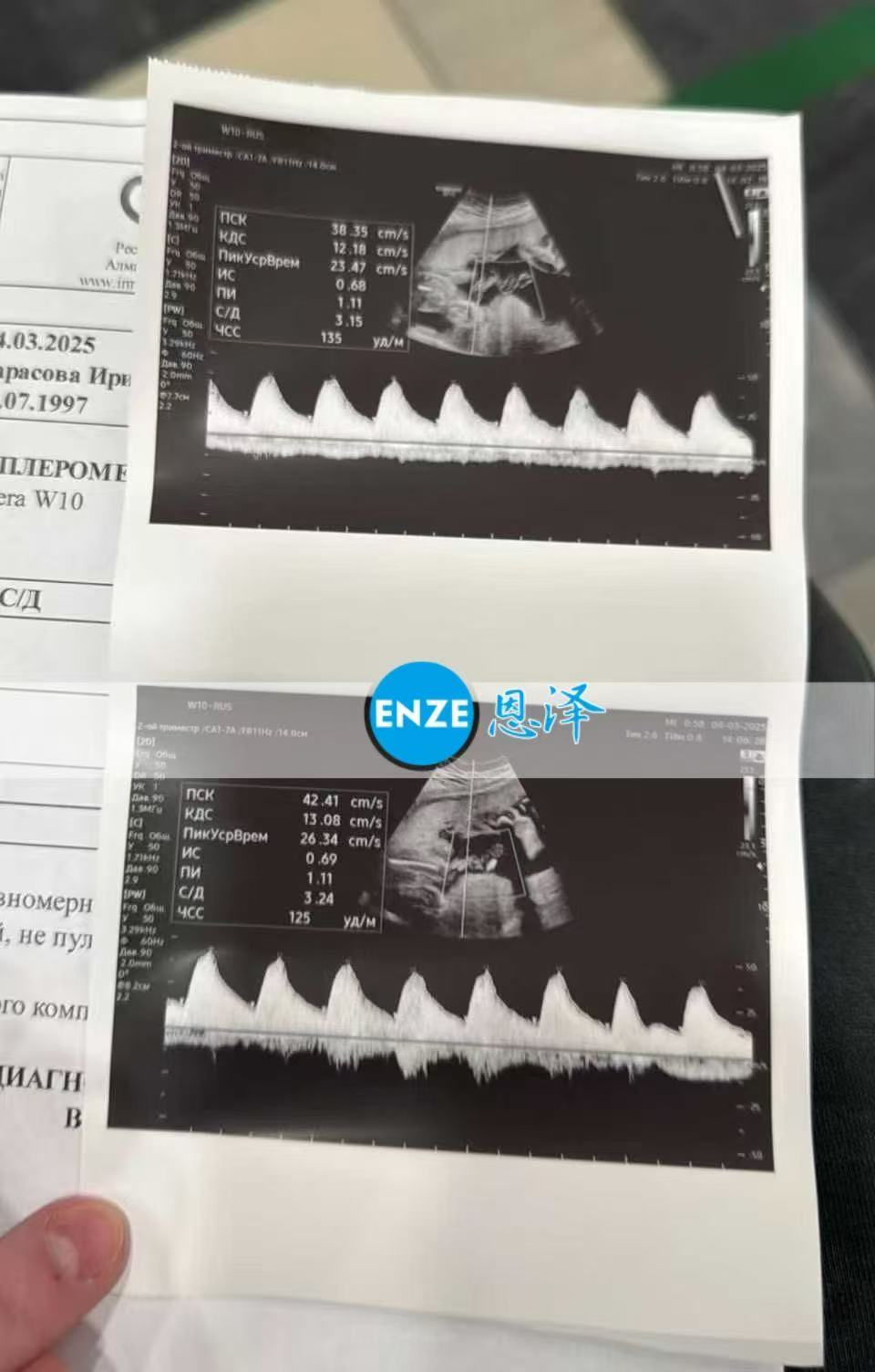 哈萨克斯坦代孕代孕代母24周产检顺利通过