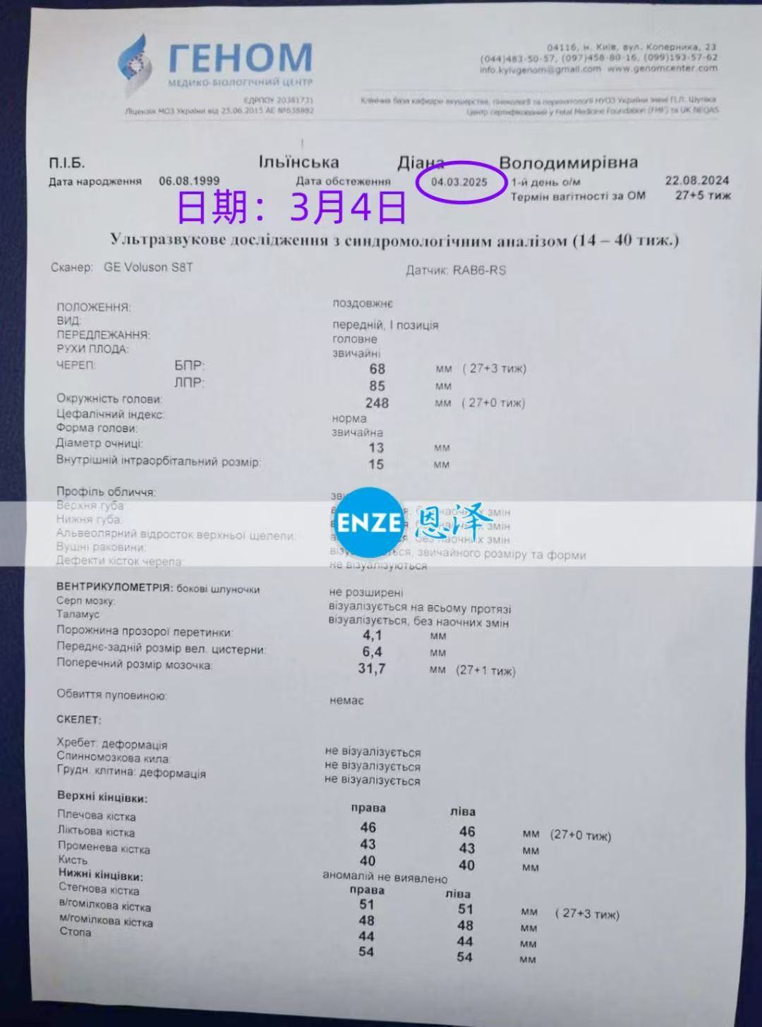 乌克兰代孕代孕代母顺利通过27周产检