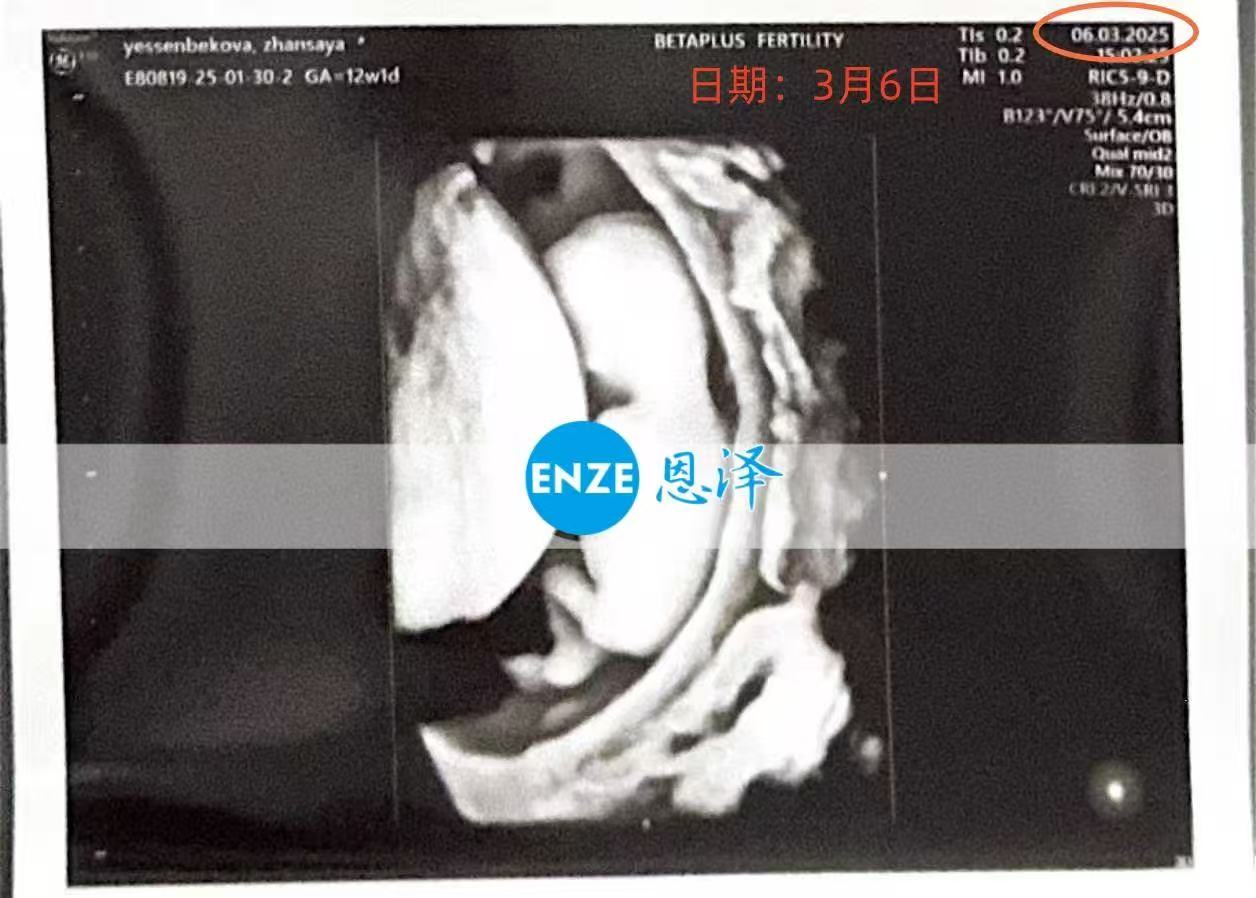 格鲁吉亚代孕代孕代母12周产检顺利，正式进入稳定期