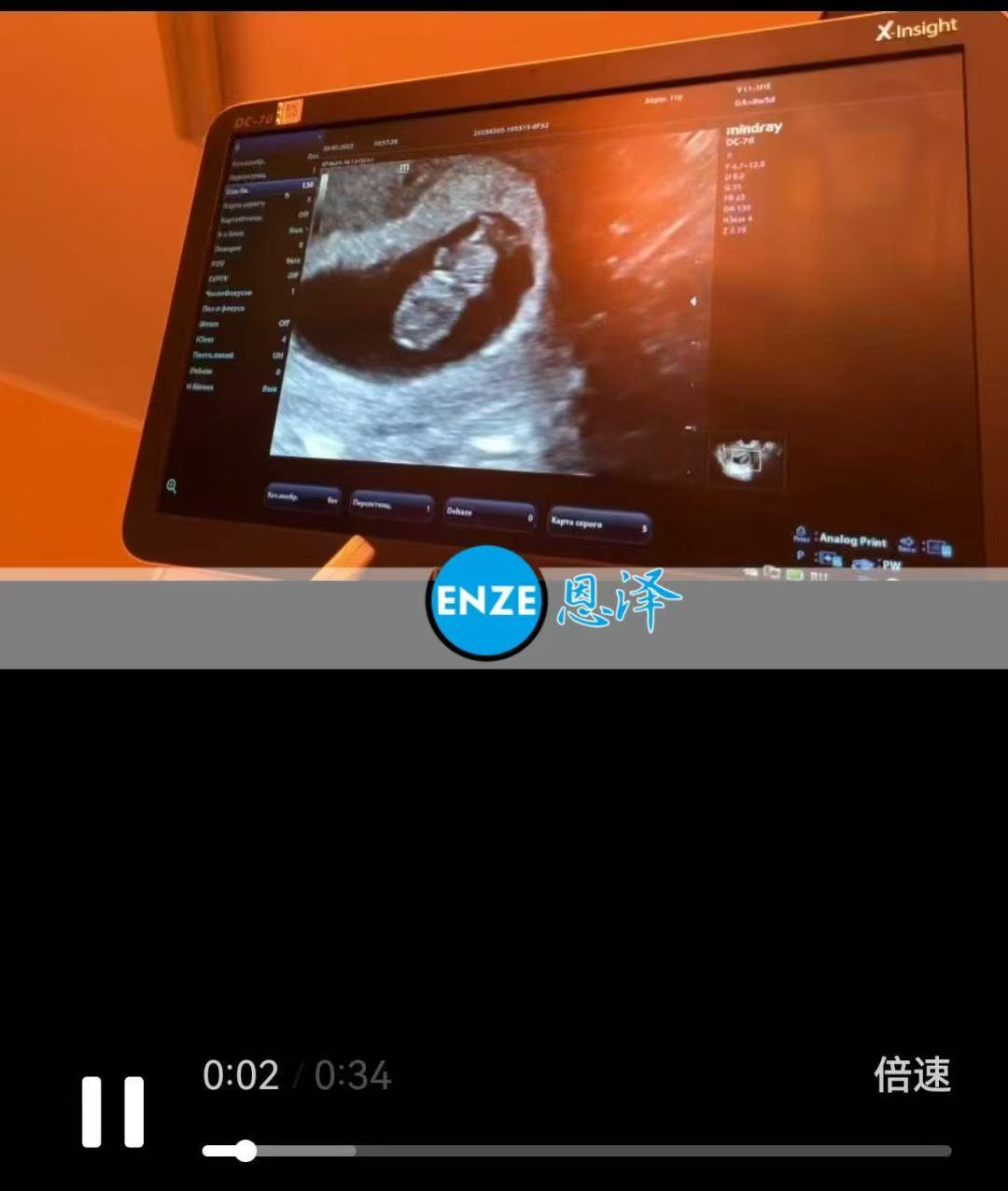 格鲁吉亚代孕代孕代母8周产检顺利通过