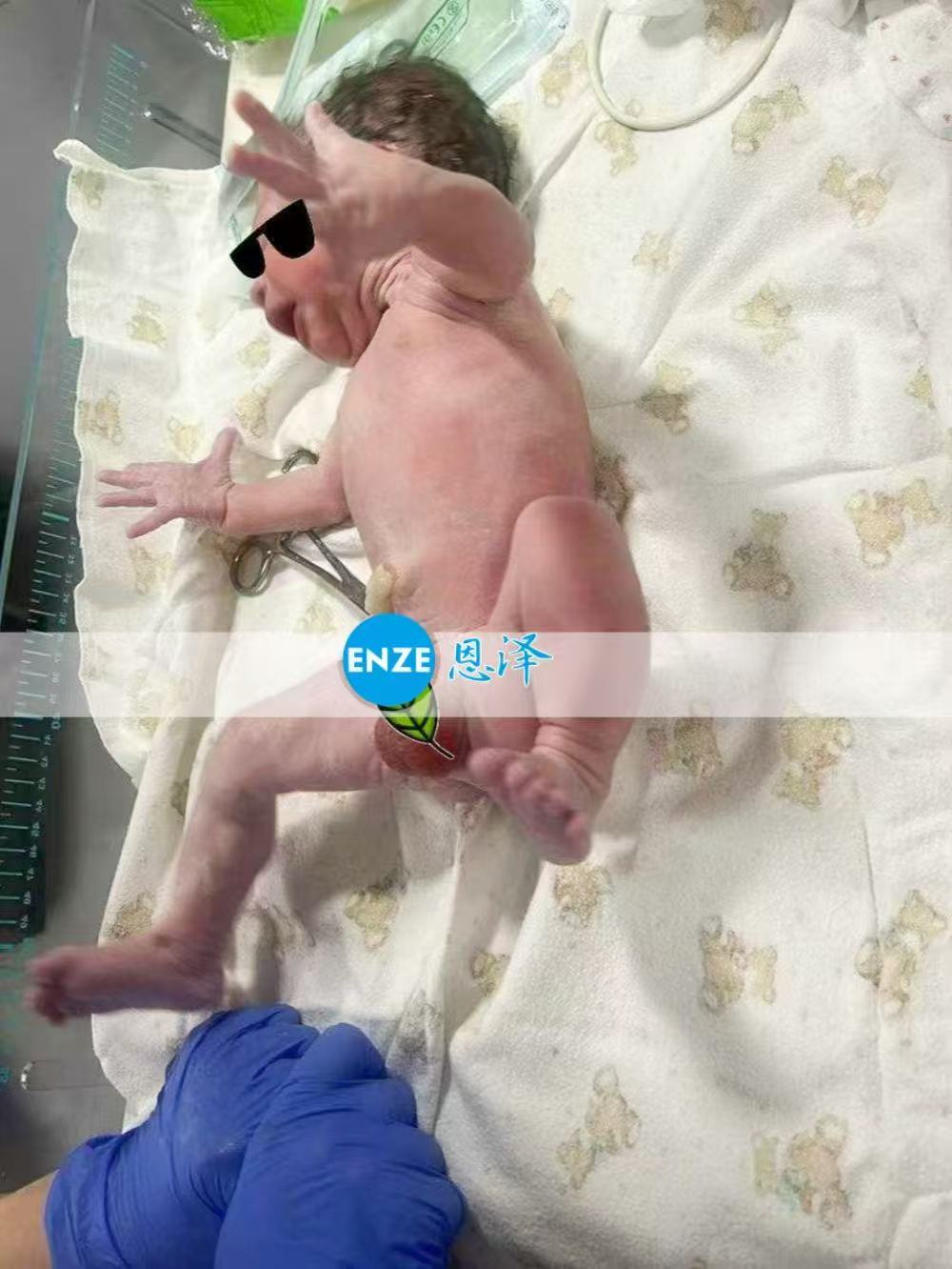 格鲁吉亚代孕宝贝健康诞生