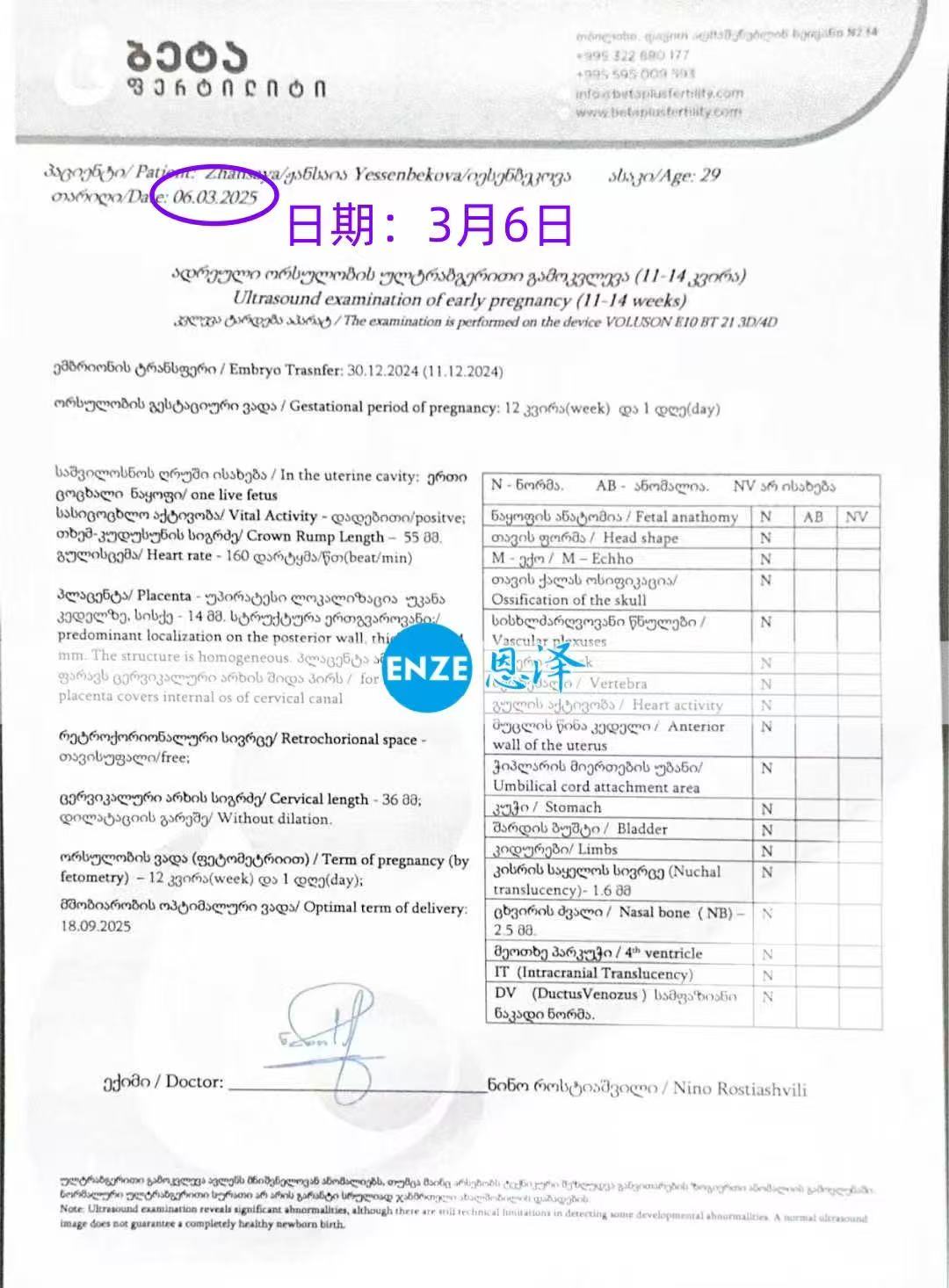 格鲁吉亚代孕代孕代母12周产检顺利，正式进入稳定期