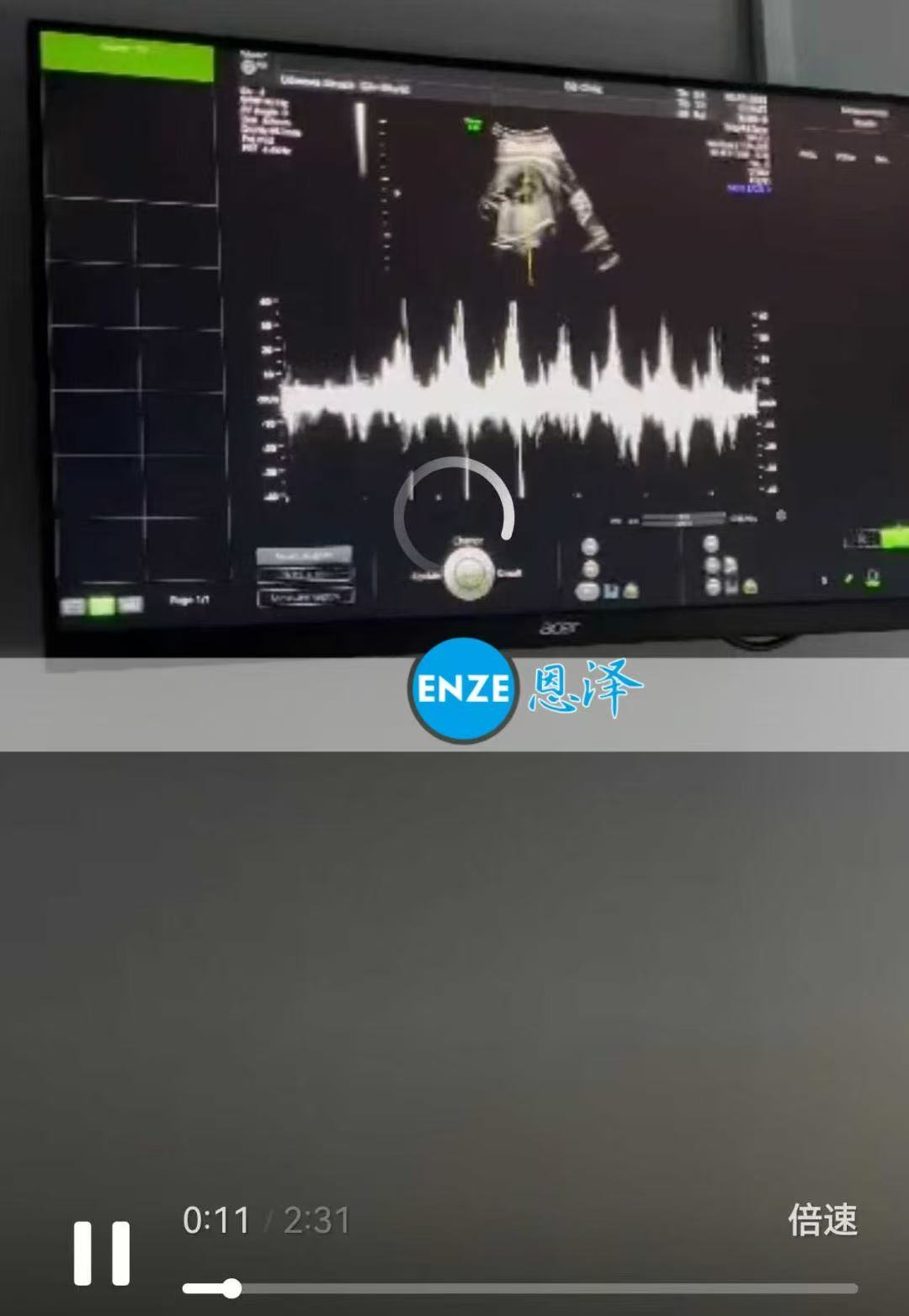 格鲁吉亚代孕代孕代母通过36周产检，即将迎来新生命