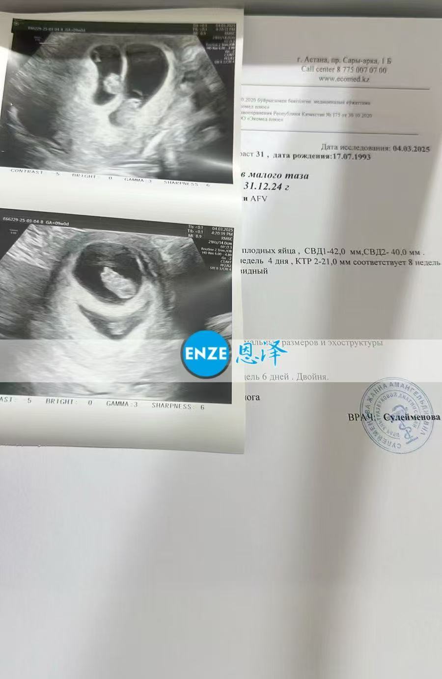 格鲁吉亚代孕代孕代母8周产检顺利通过