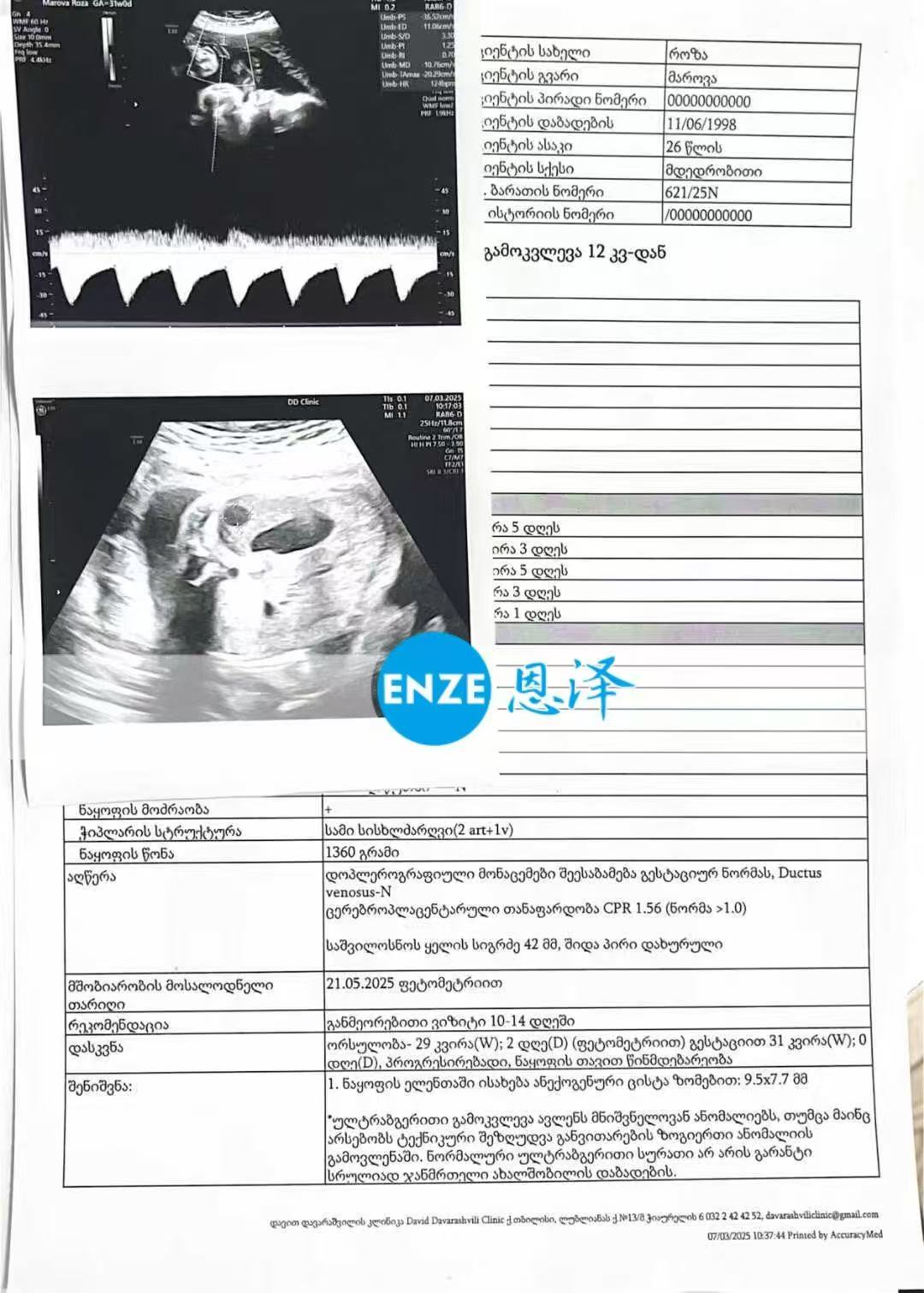 格鲁吉亚代孕代孕代母29周产检进展顺利