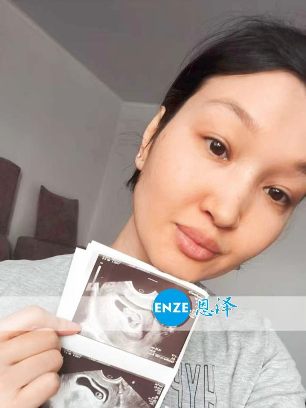 格鲁吉亚代孕代孕代母8周产检进展顺利