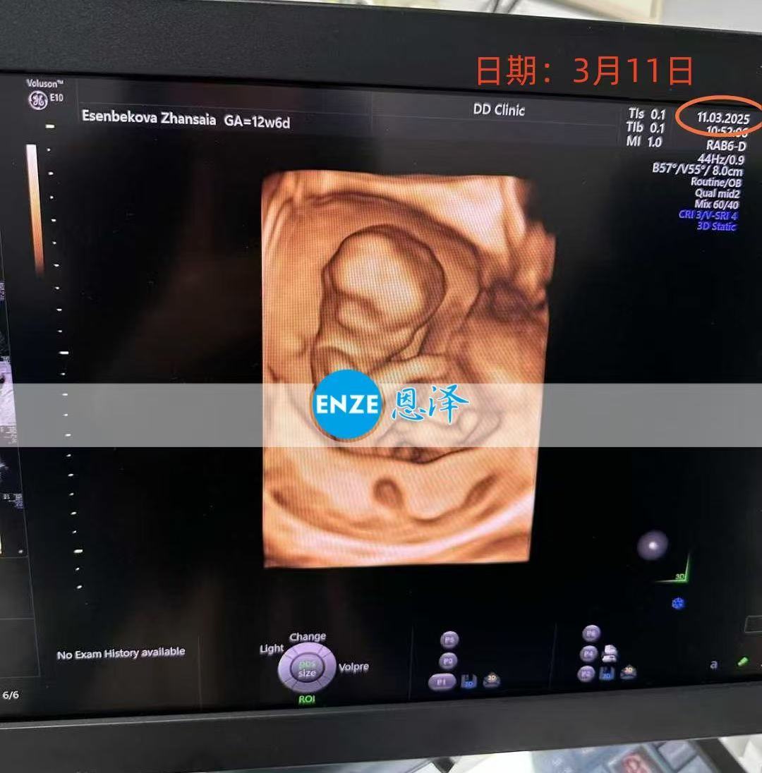 格鲁吉亚代孕代孕代母通过13周产检，正式步入稳定期