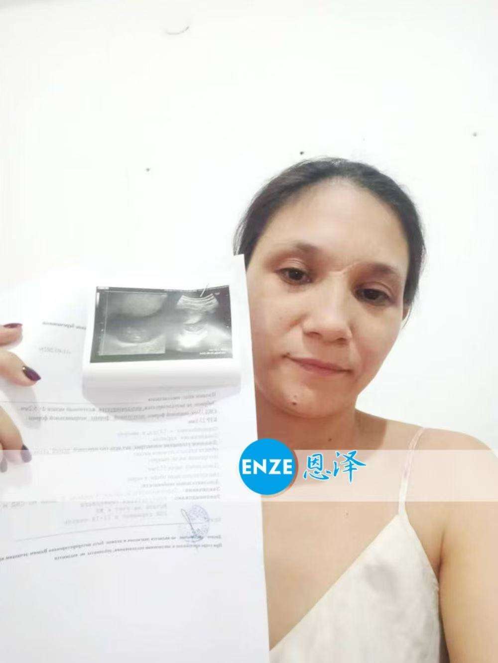 格鲁吉亚代孕代母9周产检顺利过关
