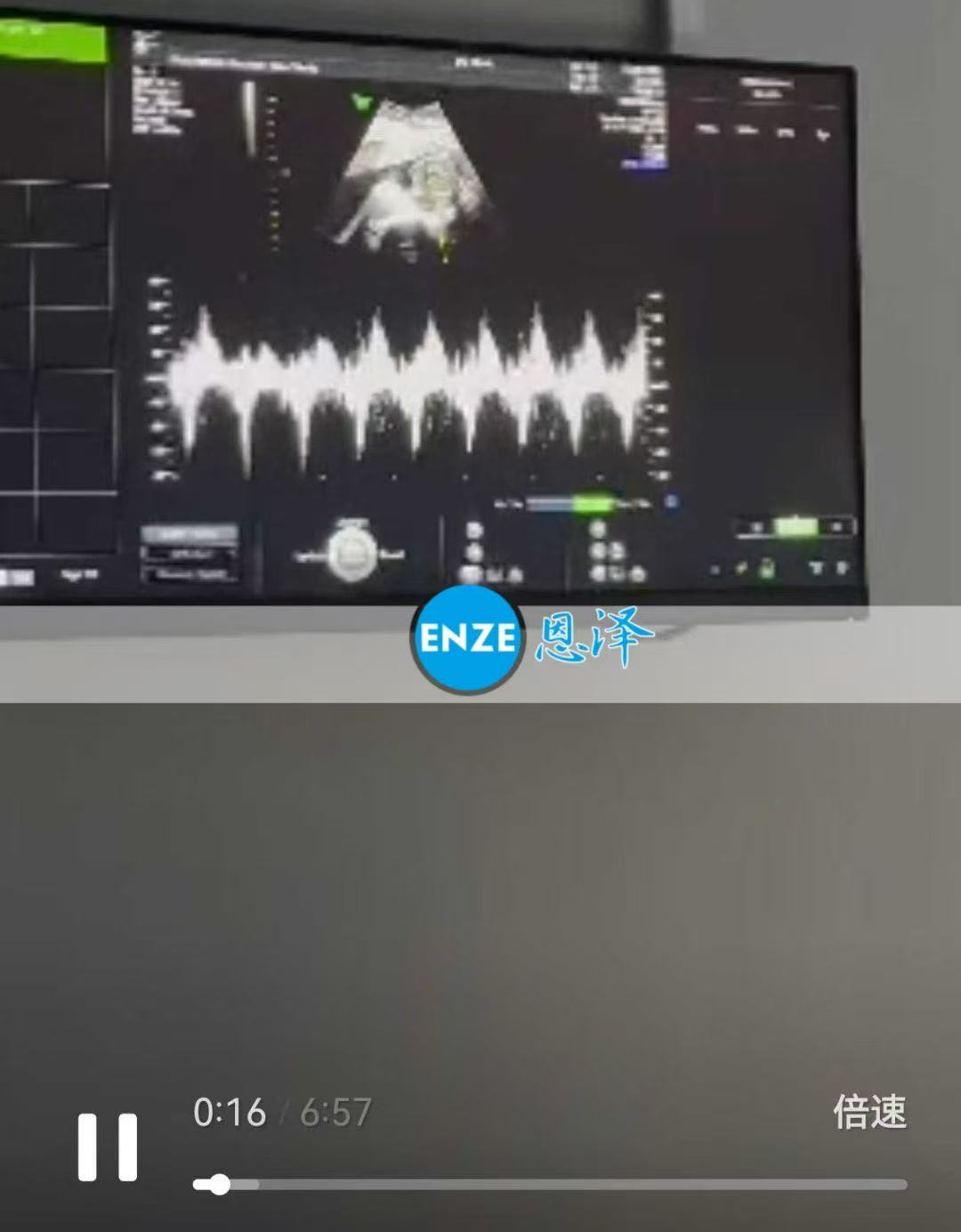 格鲁吉亚代孕代孕代母19周产检顺利通过