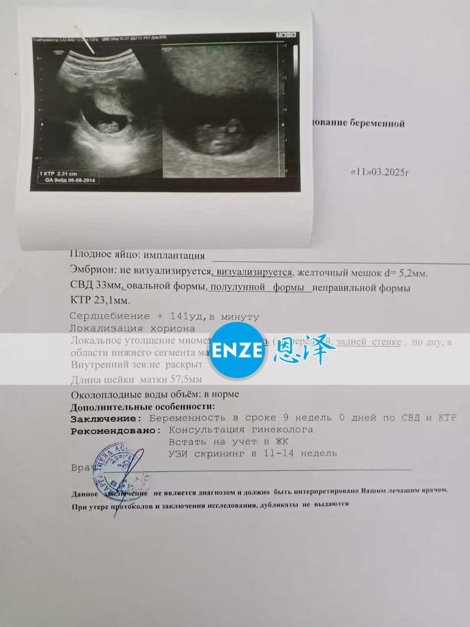 格鲁吉亚代孕代孕代母9周产检顺利过关