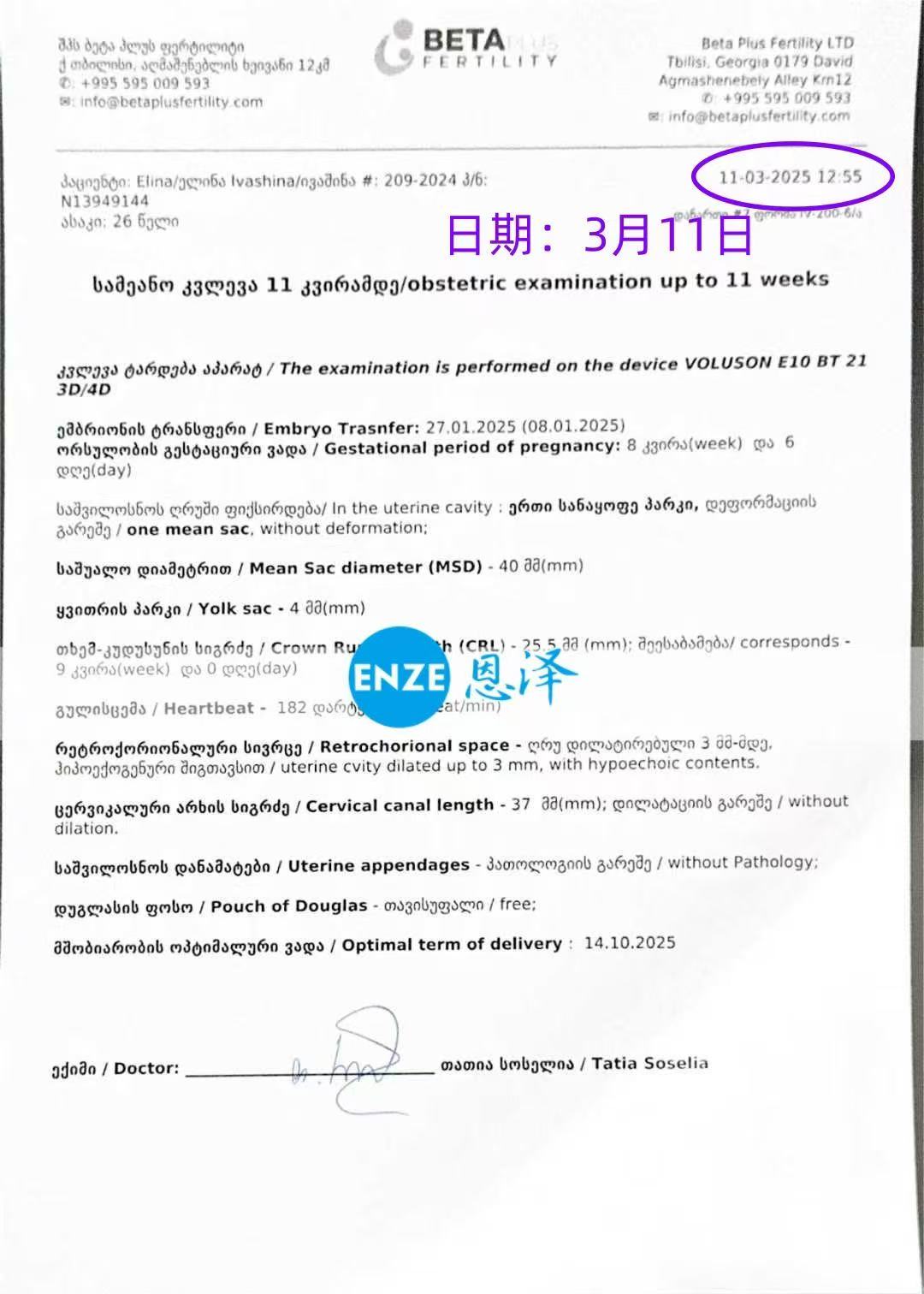 格鲁吉亚代孕代孕代母8周产检顺利通过