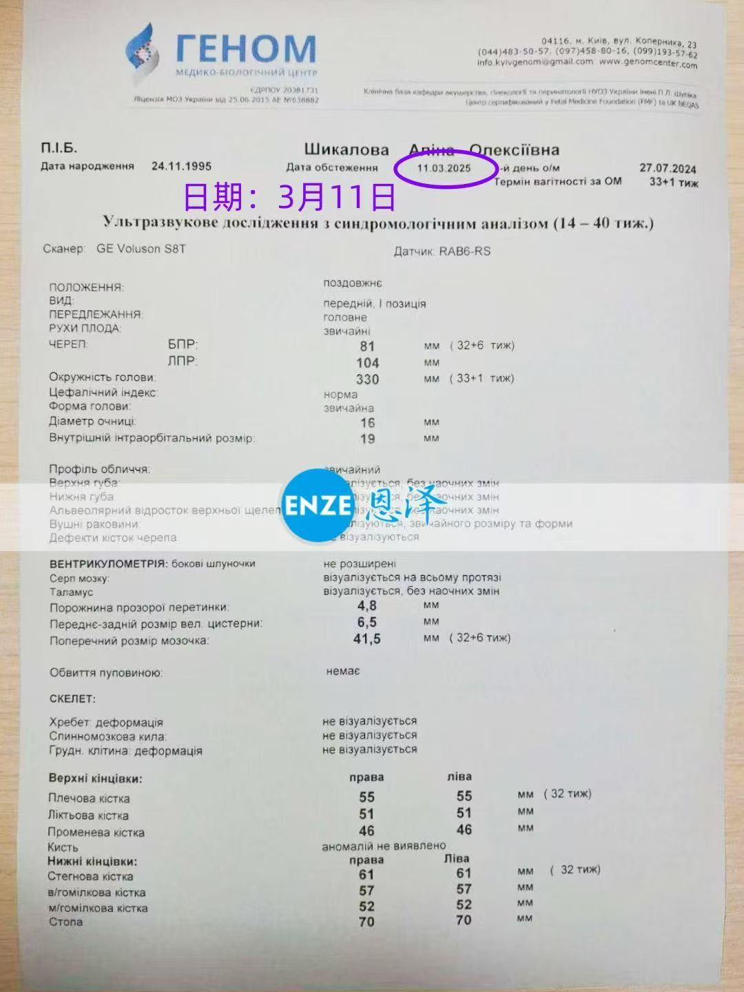 格鲁吉亚代孕代孕代母32周产检顺利通过