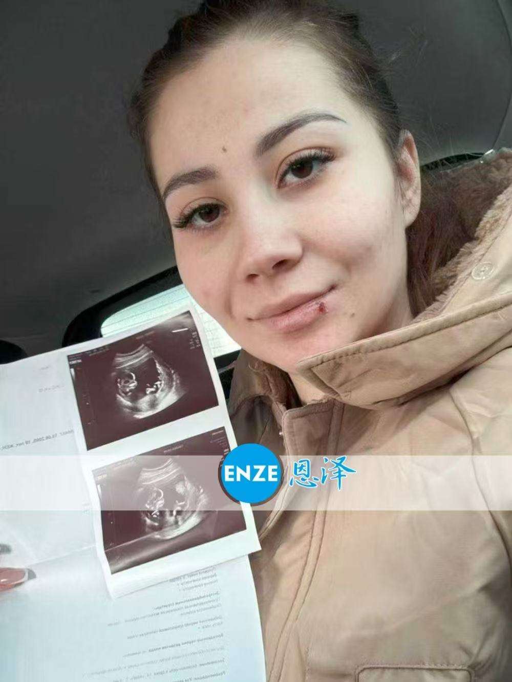 格鲁吉亚代孕代母顺利通过14周产检
