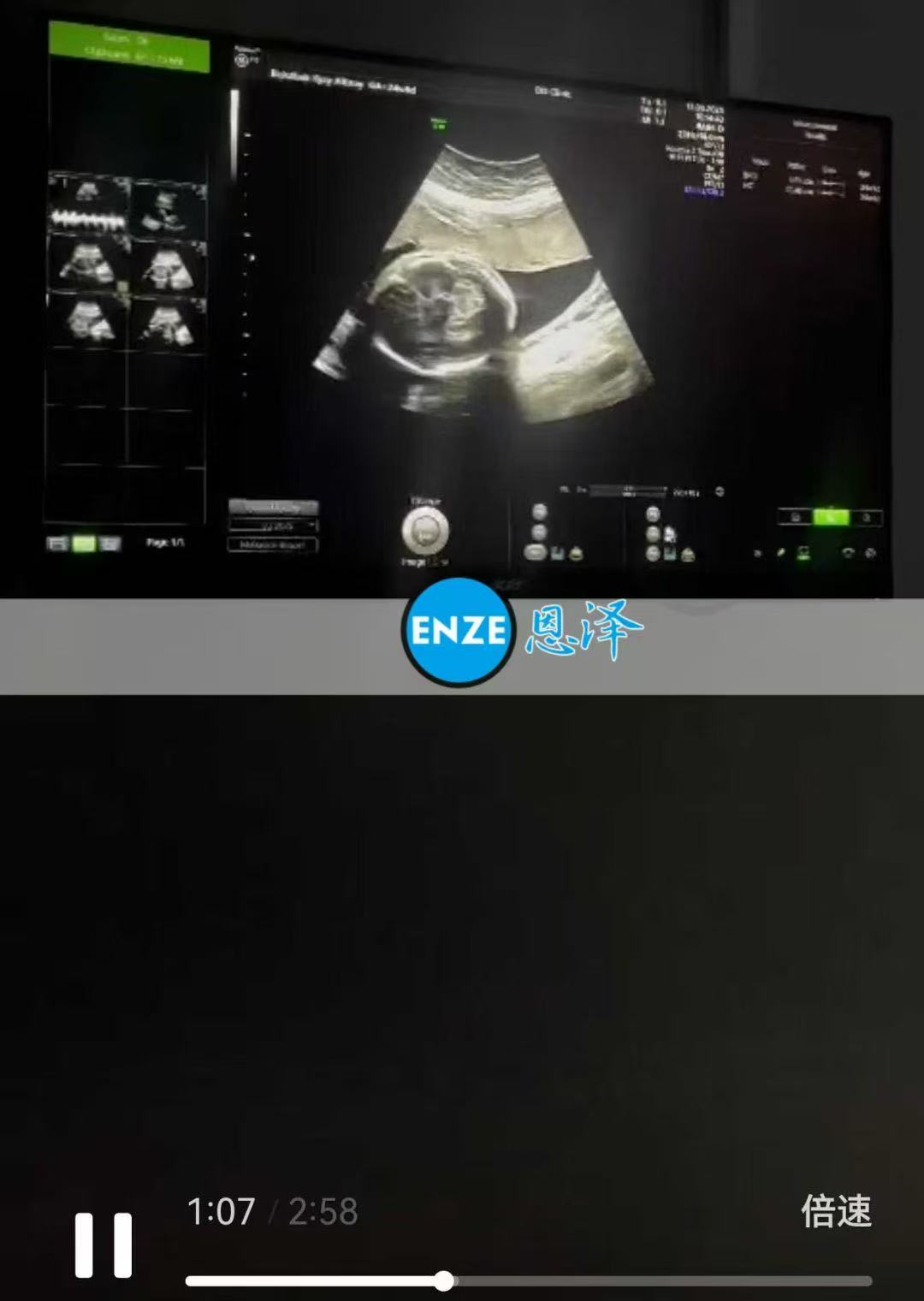 格鲁吉亚代孕代孕代母24周产检顺利通过