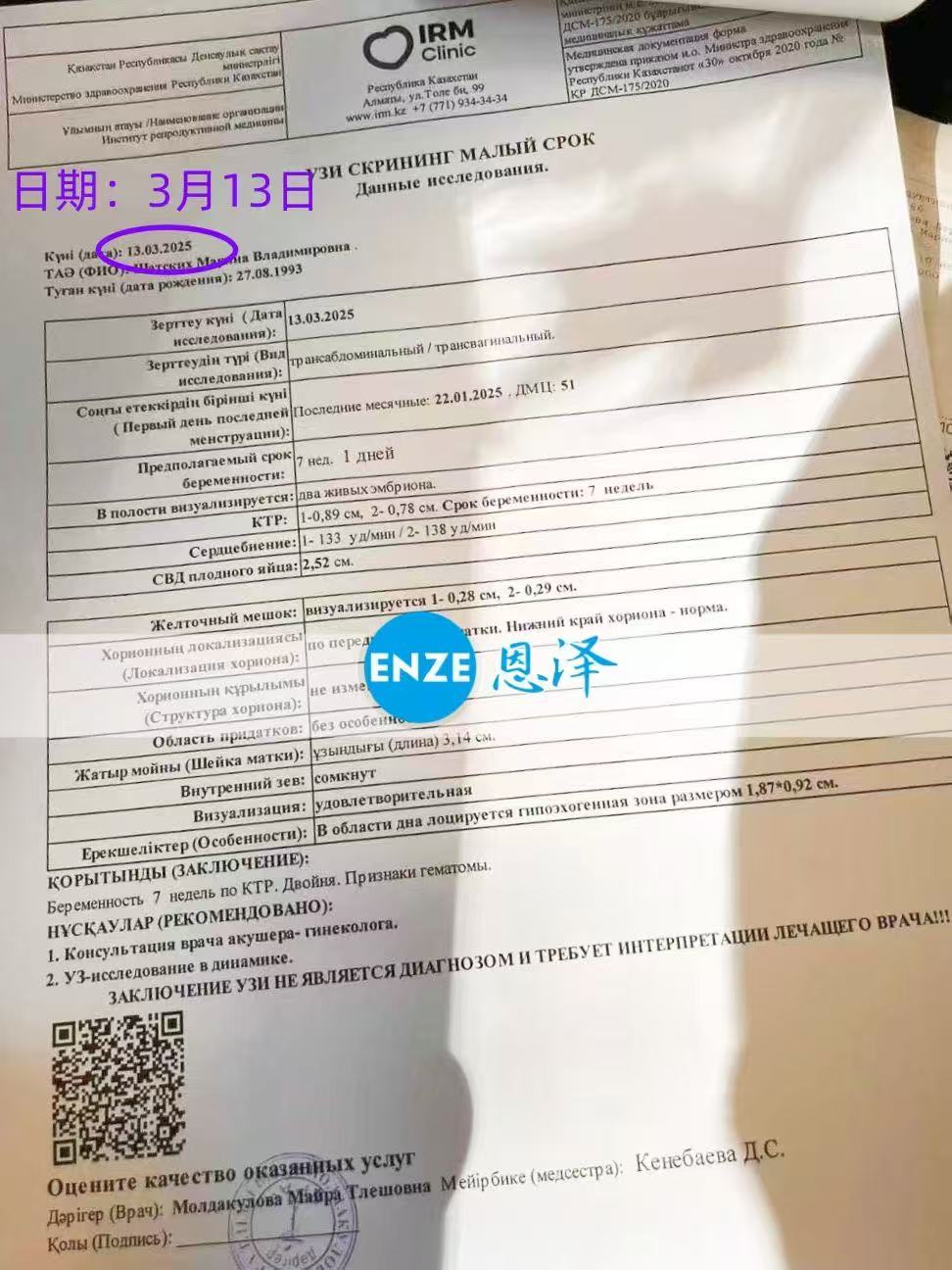 哈萨克斯坦代孕代孕代母移植胚胎分裂，孕育同卵双胞胎