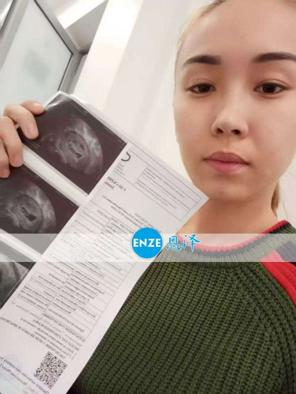 哈萨克斯坦代孕代母7周产检顺利通过