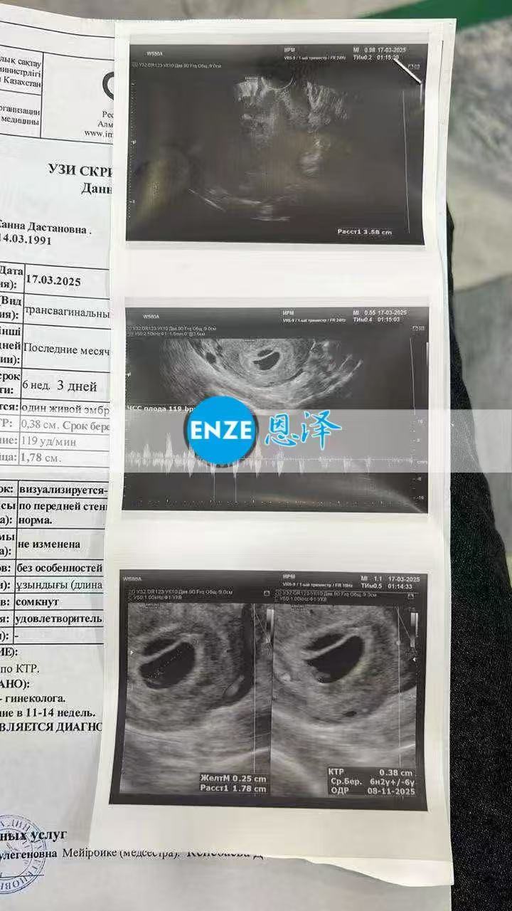 哈萨克斯坦代孕代孕代母6周产检顺利通过