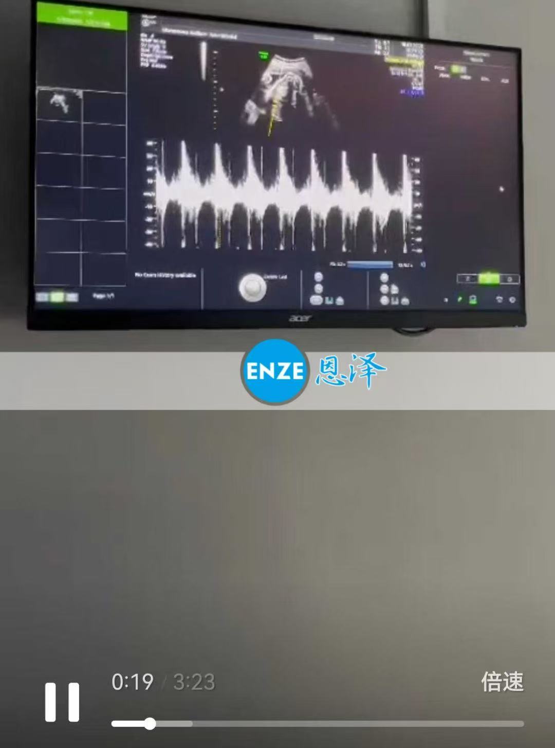格鲁吉亚代孕代孕代母30周产检顺利通过