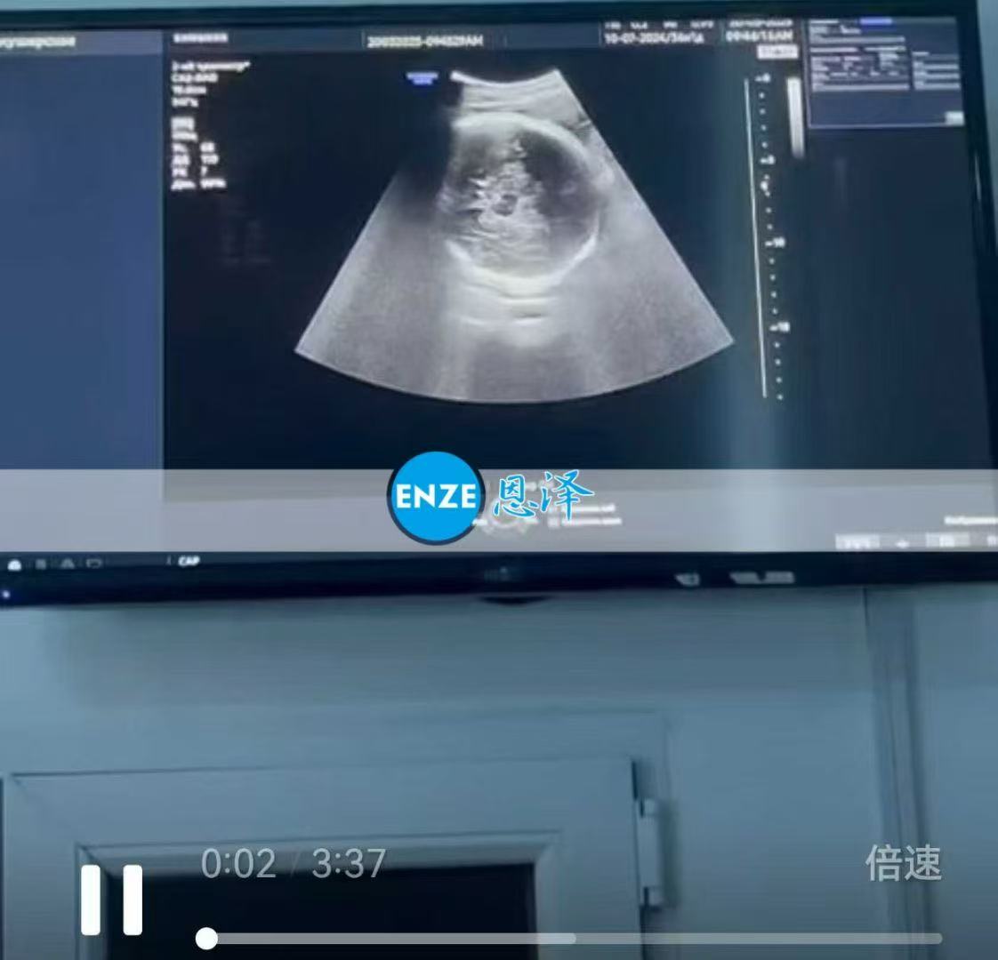哈萨克斯坦代孕代孕代母36周产检顺利通过