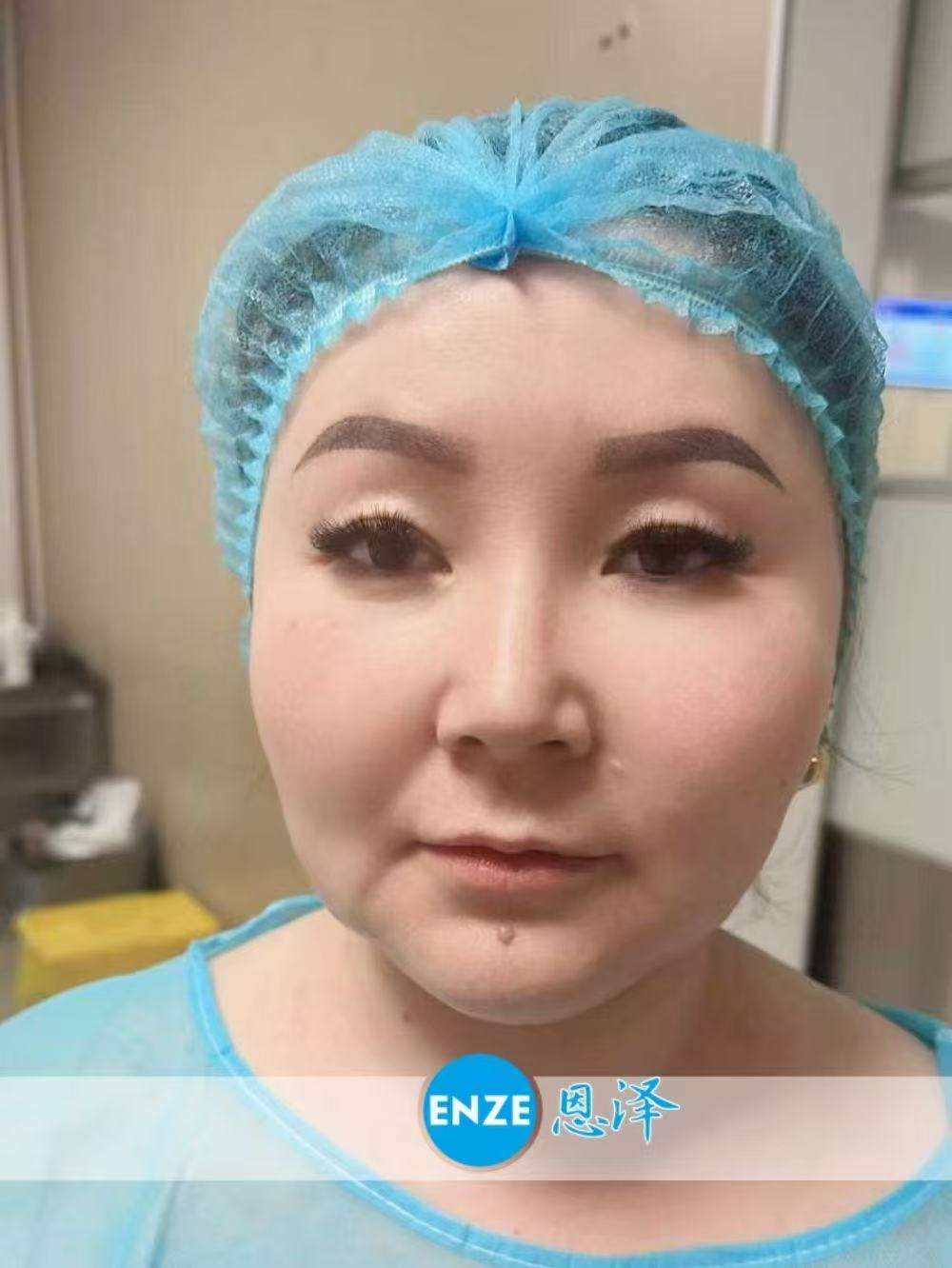 格鲁吉亚代孕代母顺利完成移植