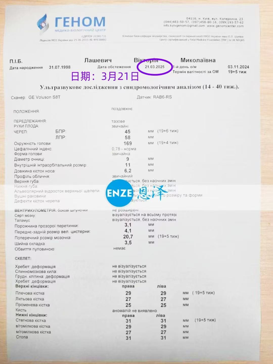 乌克兰代孕代孕代母19周产检顺利过关