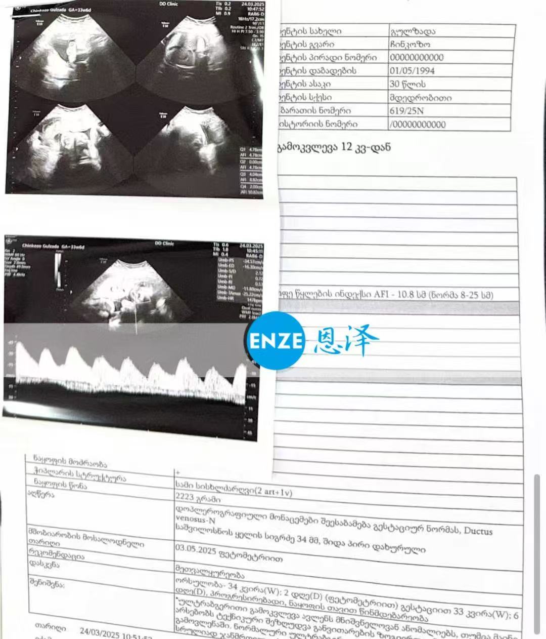 格鲁吉亚代孕代孕代母顺利通过34周产检