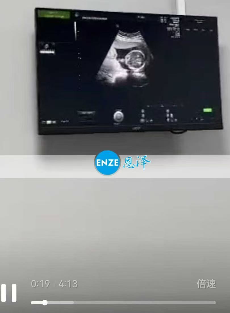 格鲁吉亚代孕代孕代母19周产检顺利过关