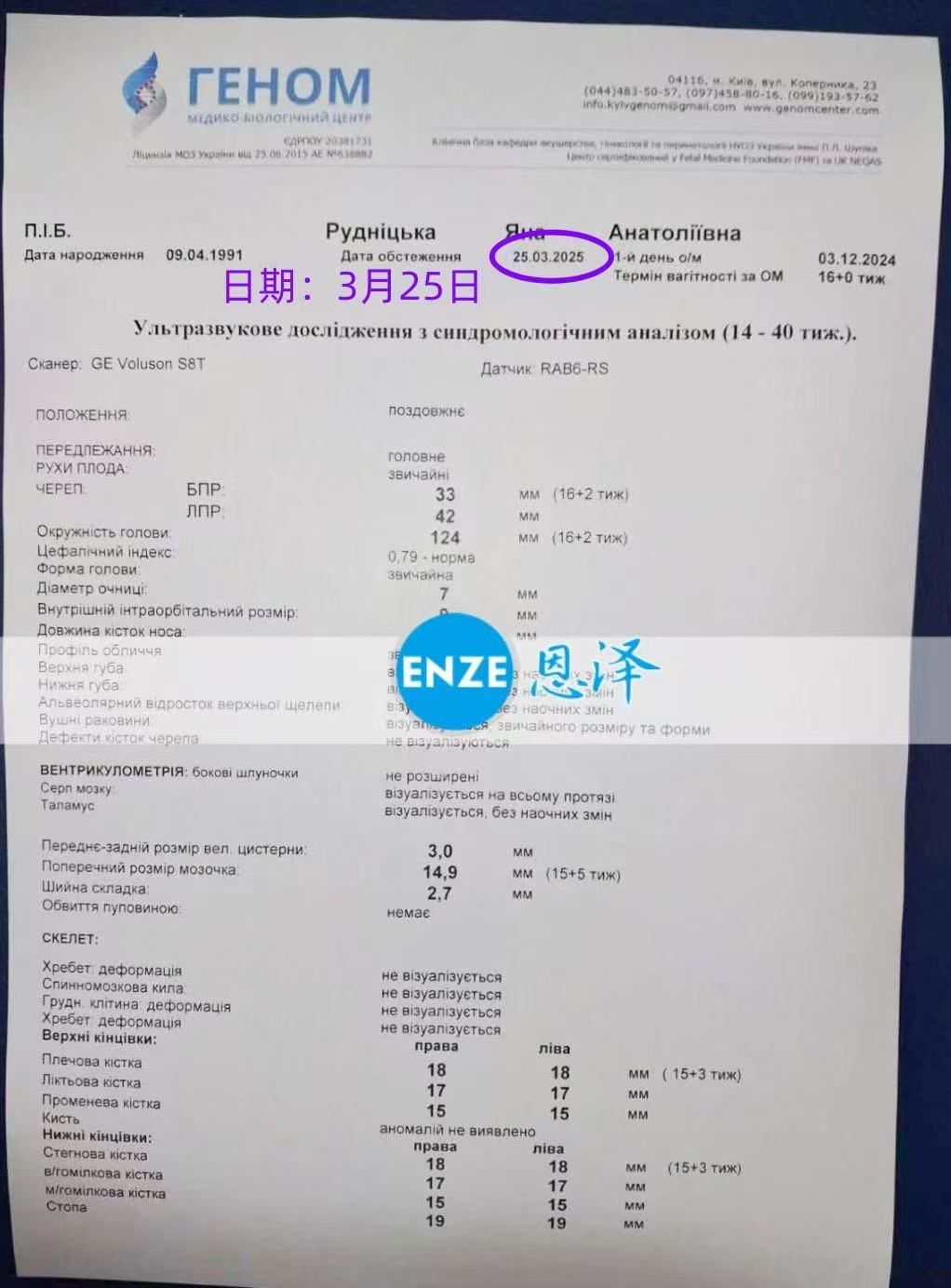 乌克兰代孕代孕代母顺利通过16周产检